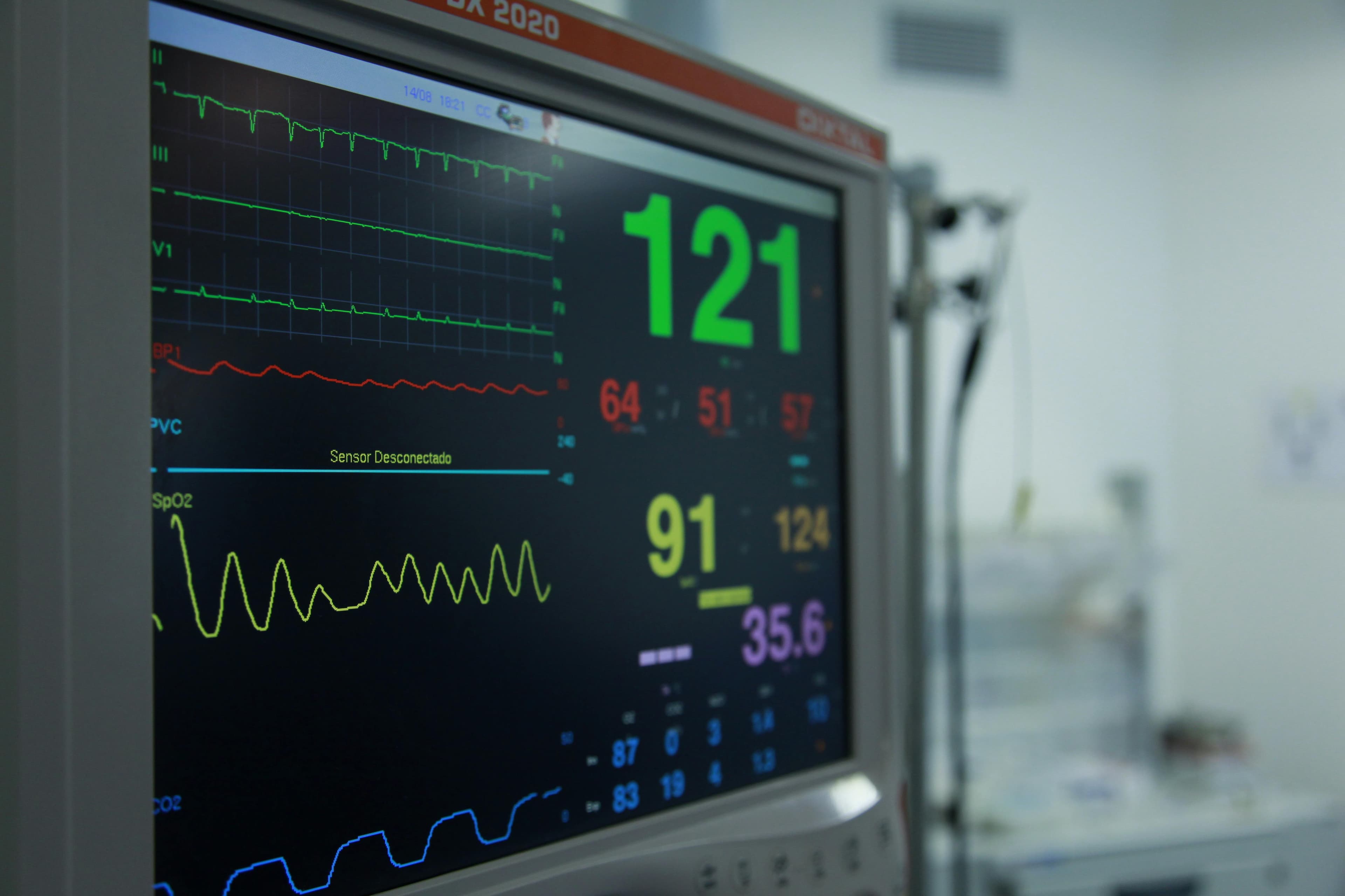 Patient being monitored in a cardiac care unit with ECG display