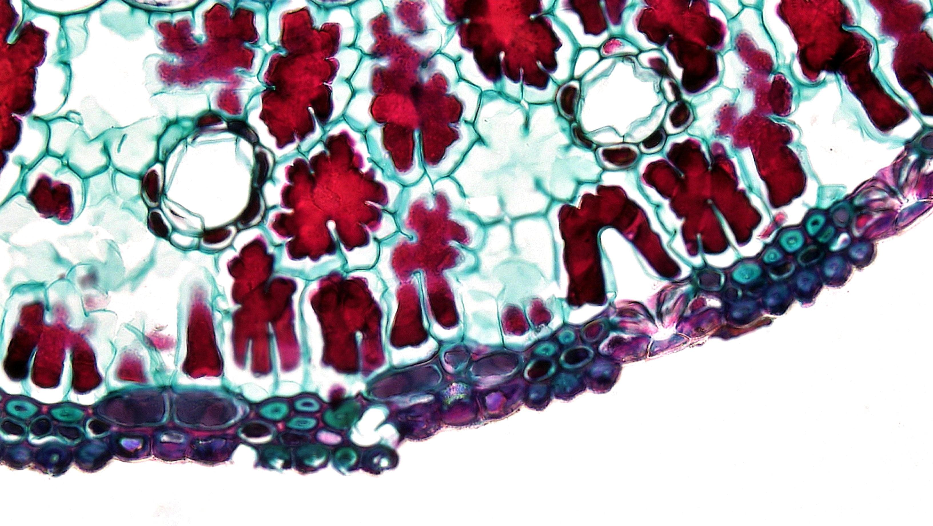 Anatomy of the Achilles tendon and surrounding structures