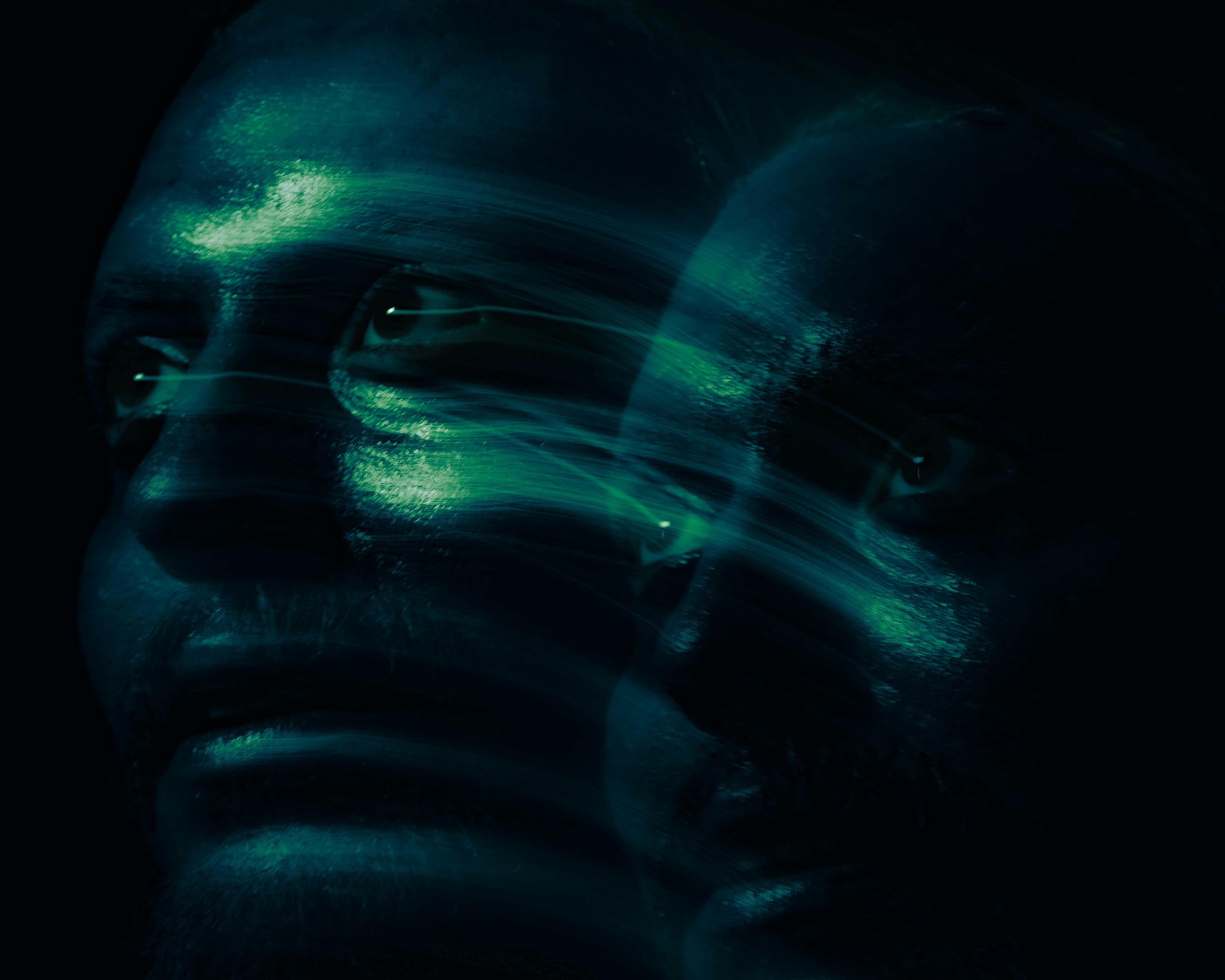 Illustration showing how cataracts can cause double vision