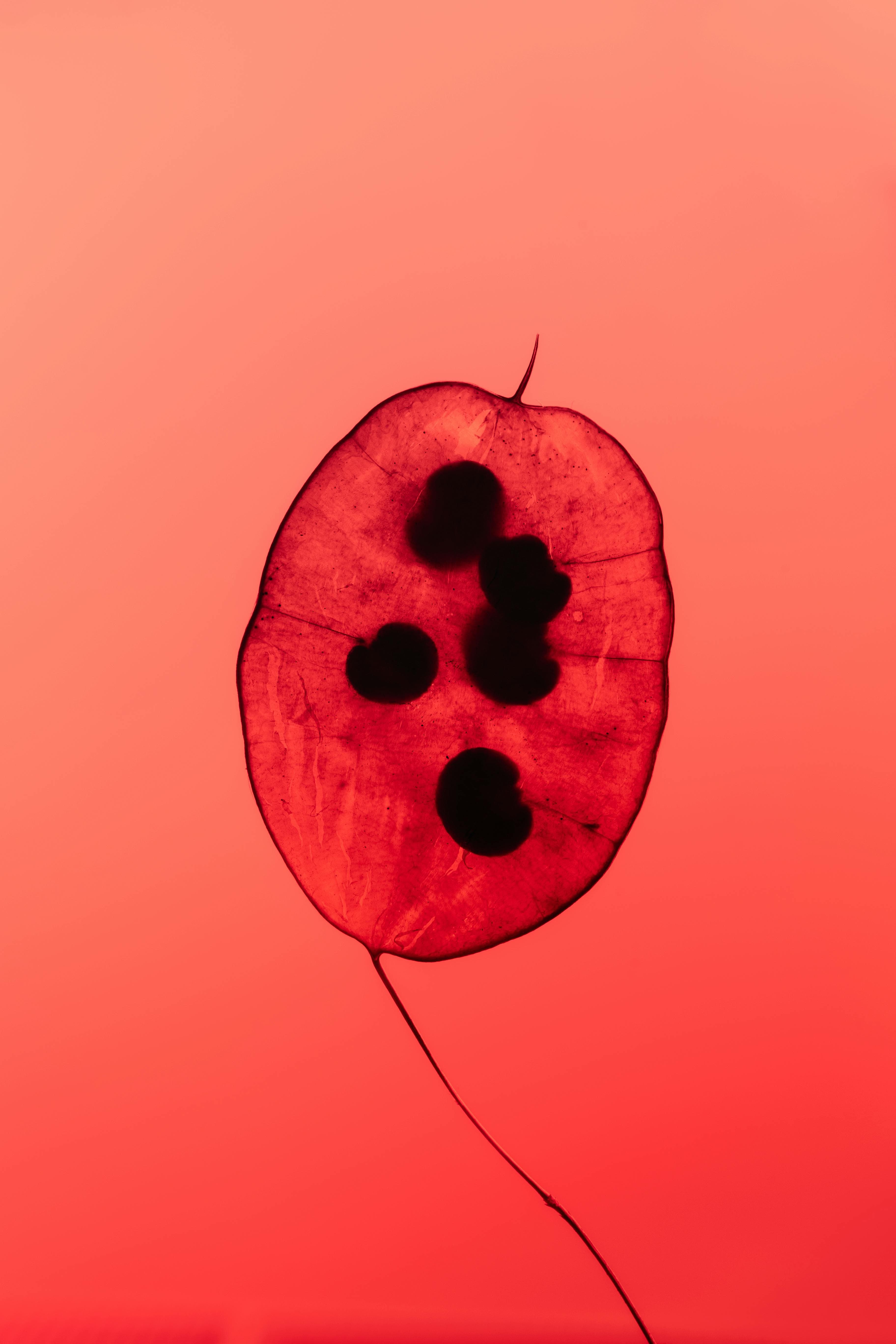 Illustration of a gastric balloon inserted in the stomach