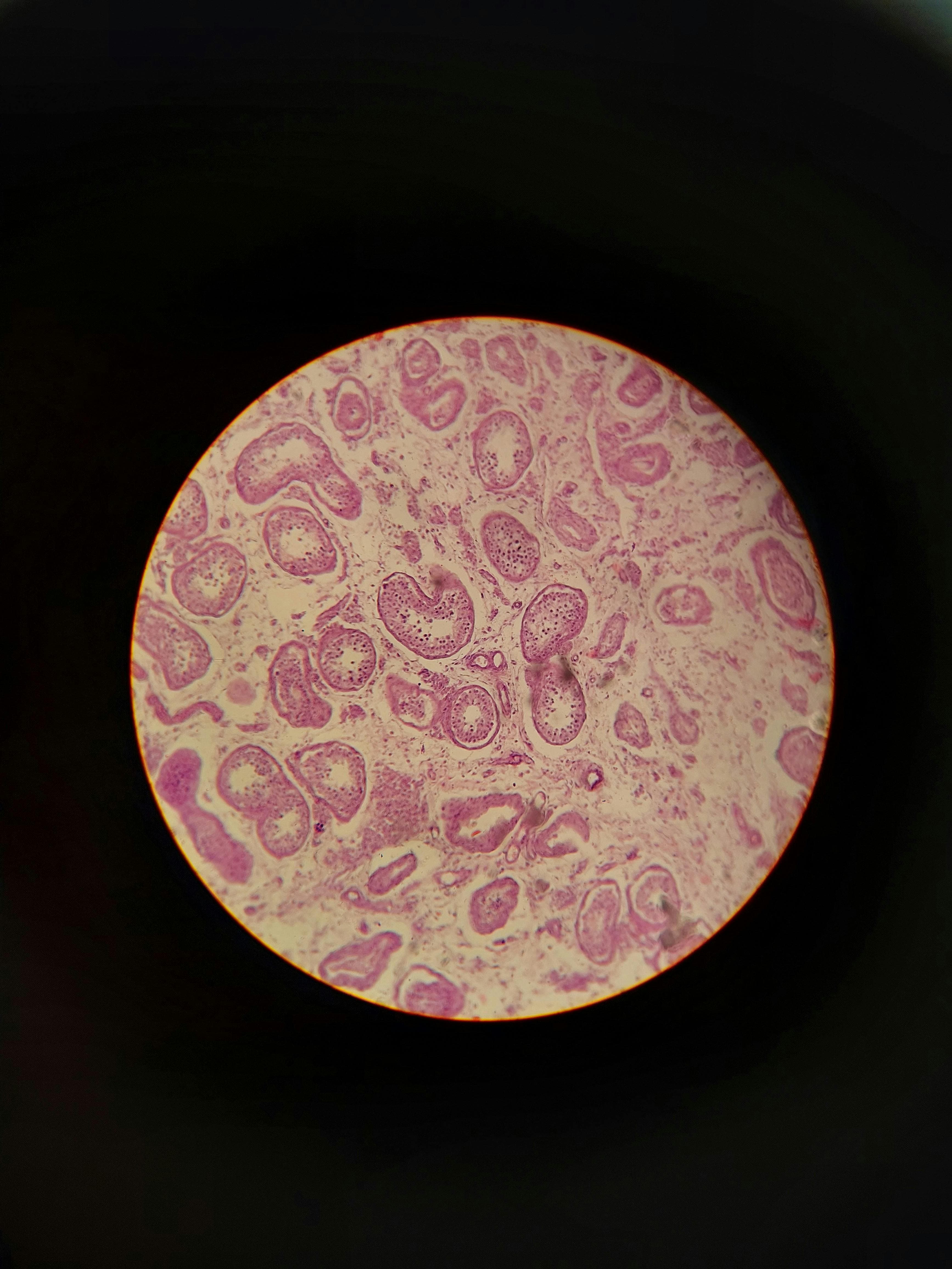 A microscopic view of corneal endothelial cells