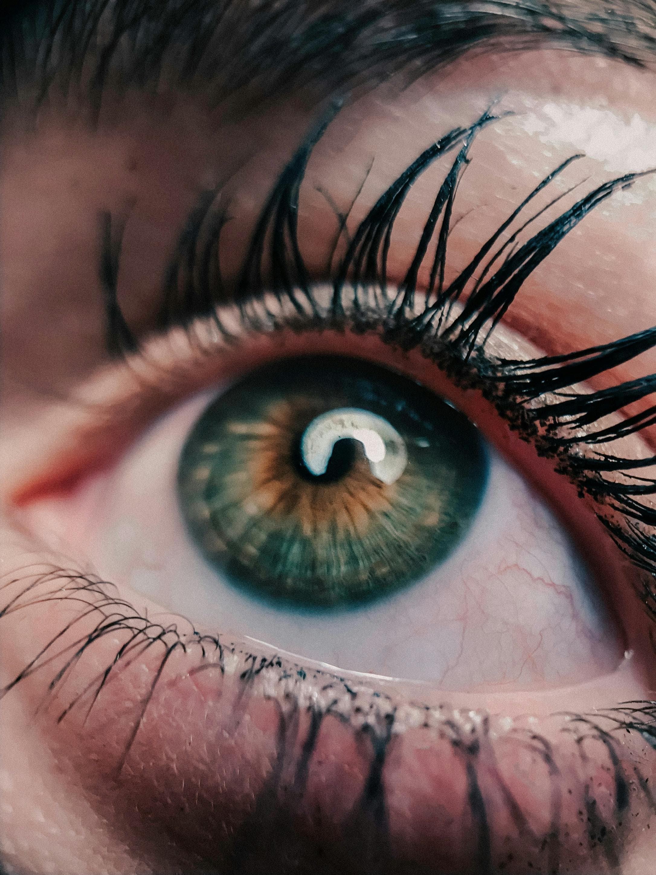 Close-up view of an eyelid margin being examined under magnification