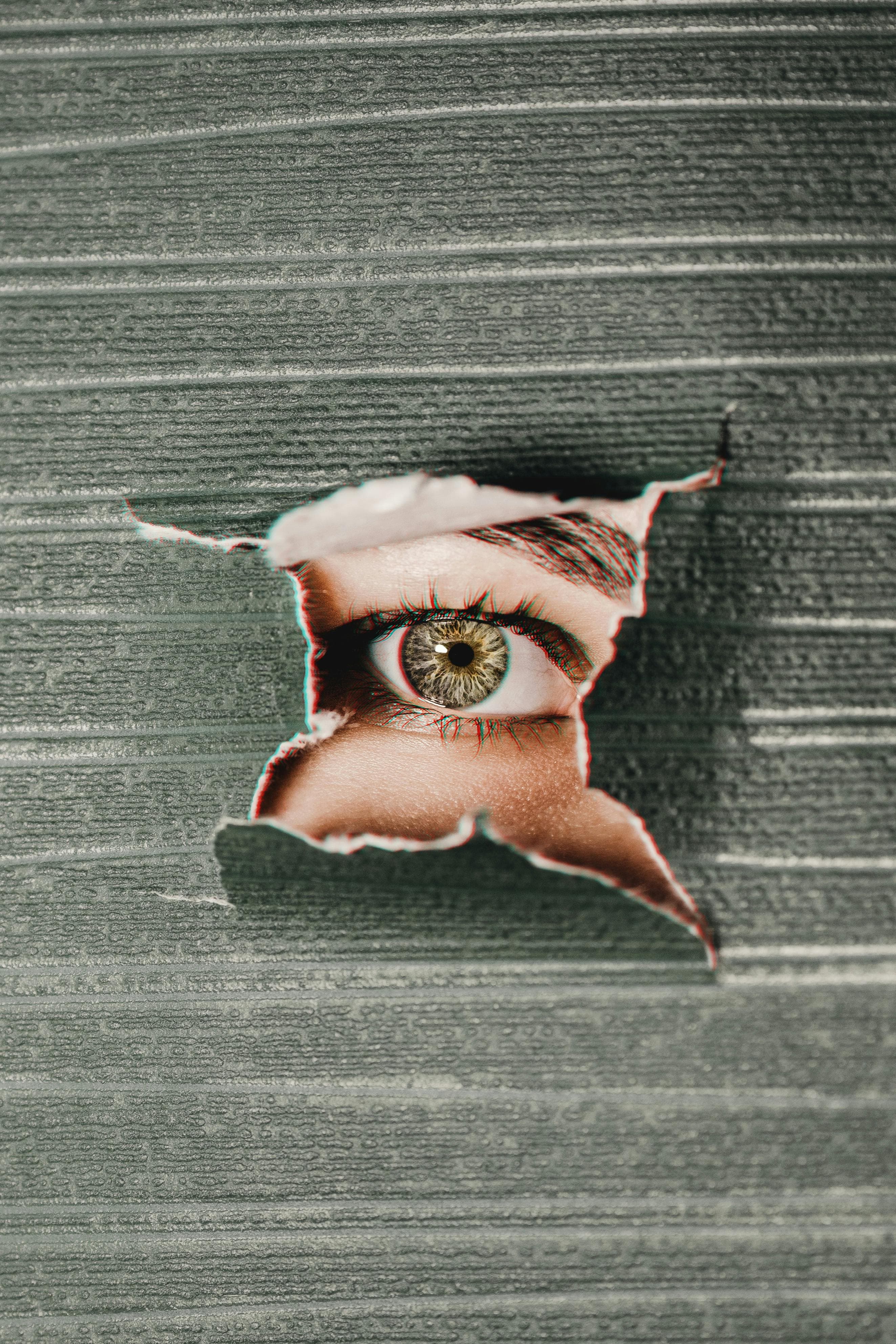 Diagram showing retinal detachment with a tear in the retina