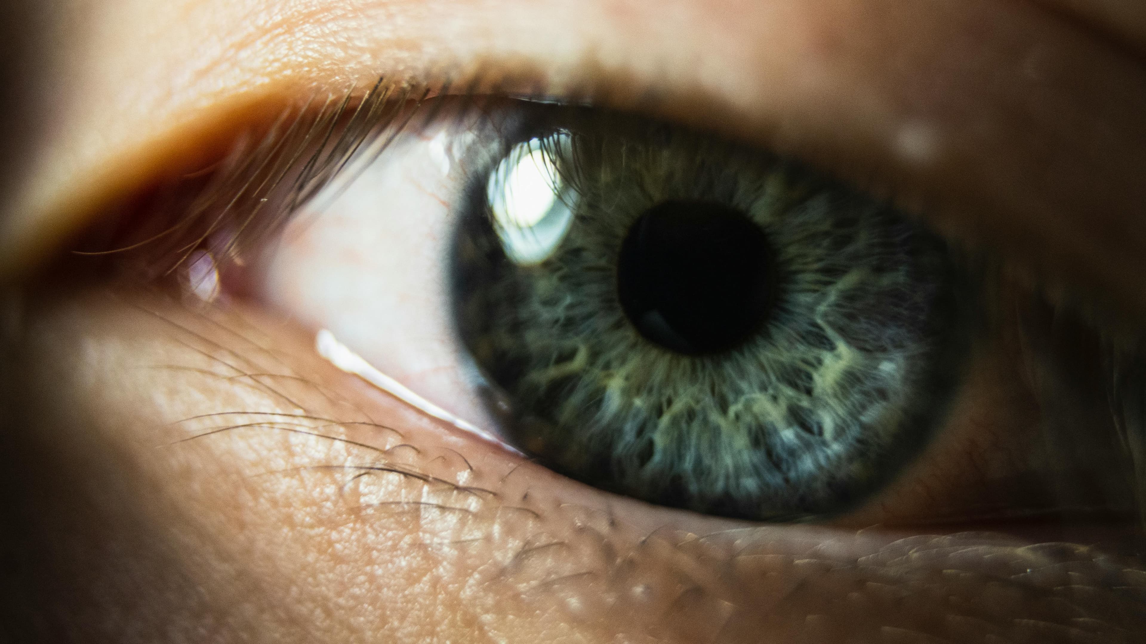 A diagram showing eye floaters in the field of vision
