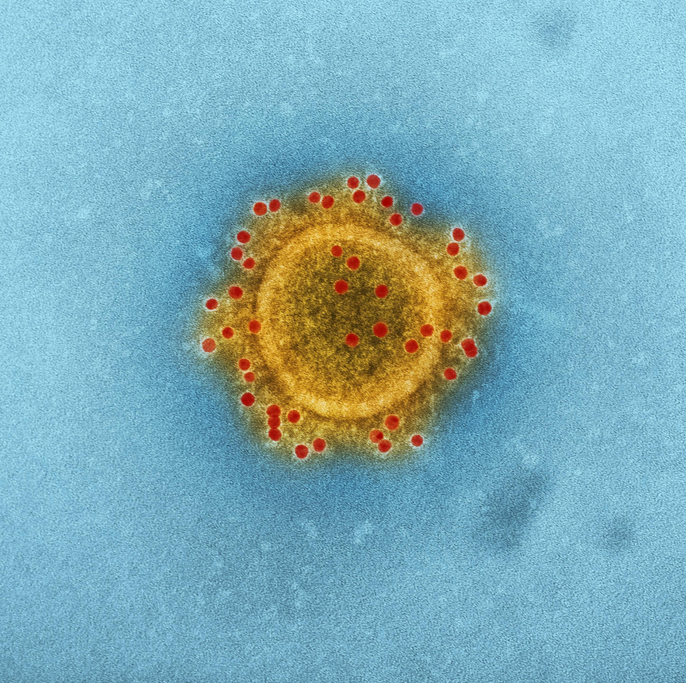 Microscopic view of common bacteria found in contaminated eye drops