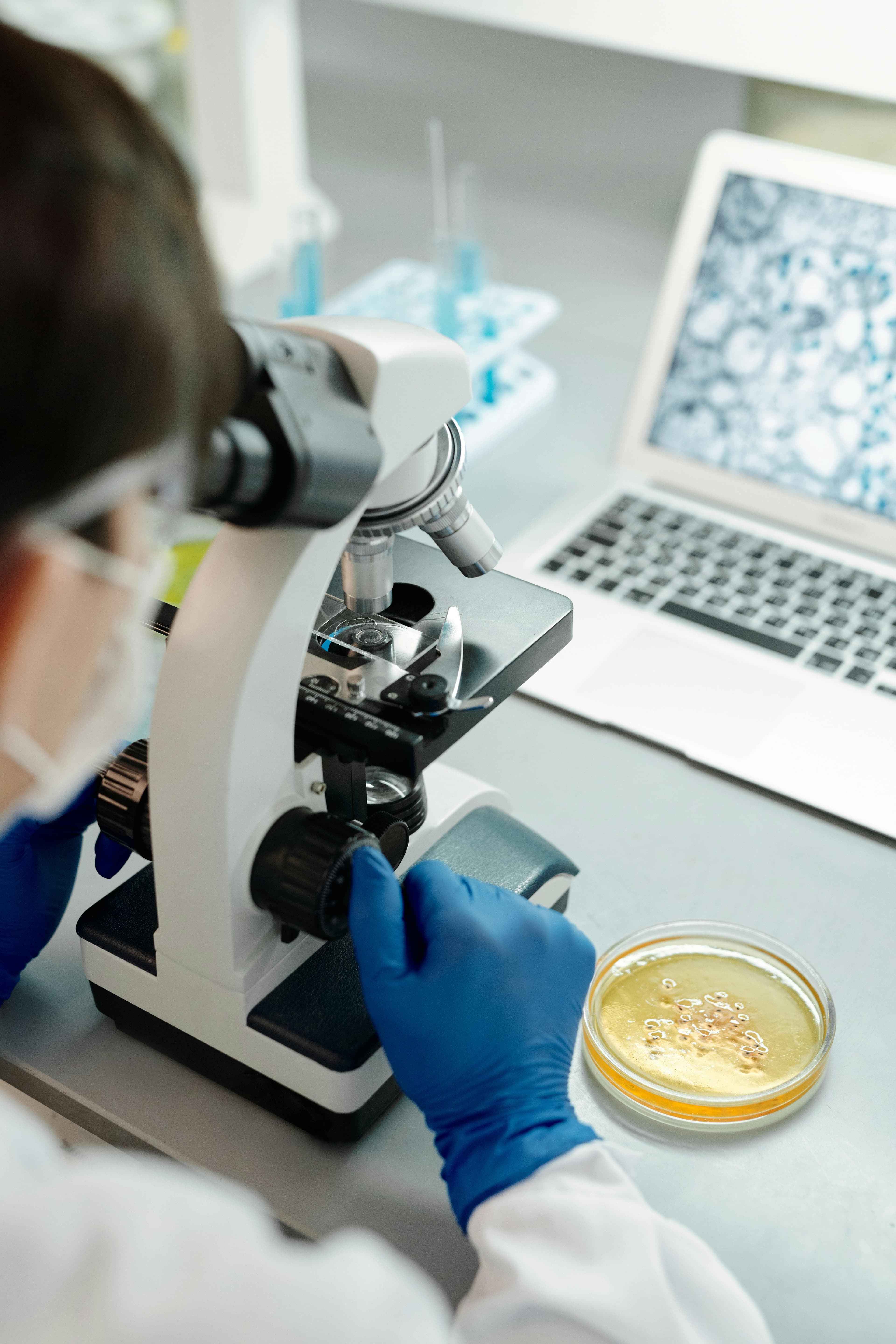 A microscopic view of a corneal scraping sample being analyzed in a laboratory