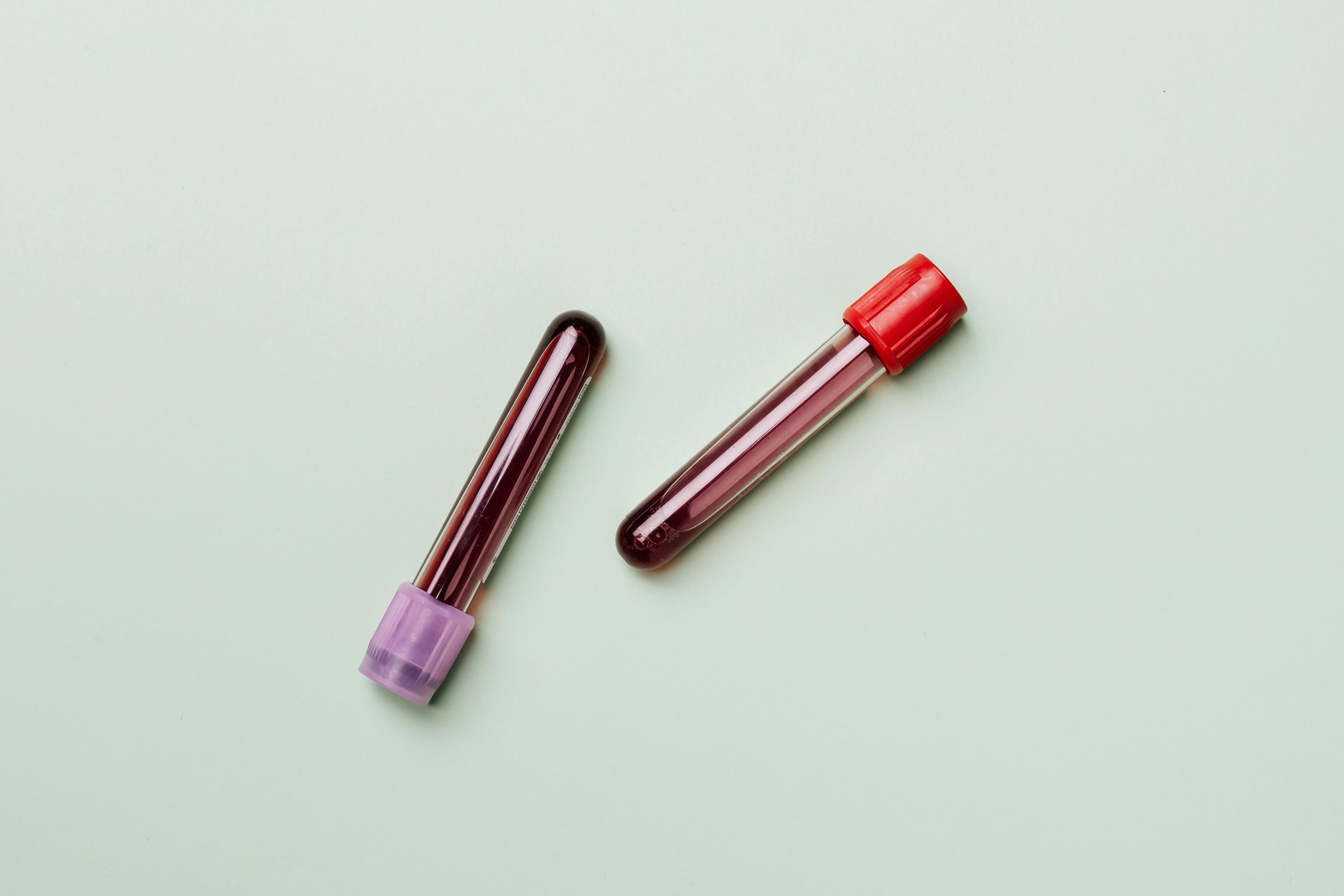 A vial of blood showing separated red blood cells and plasma, illustrating hematocrit measurement