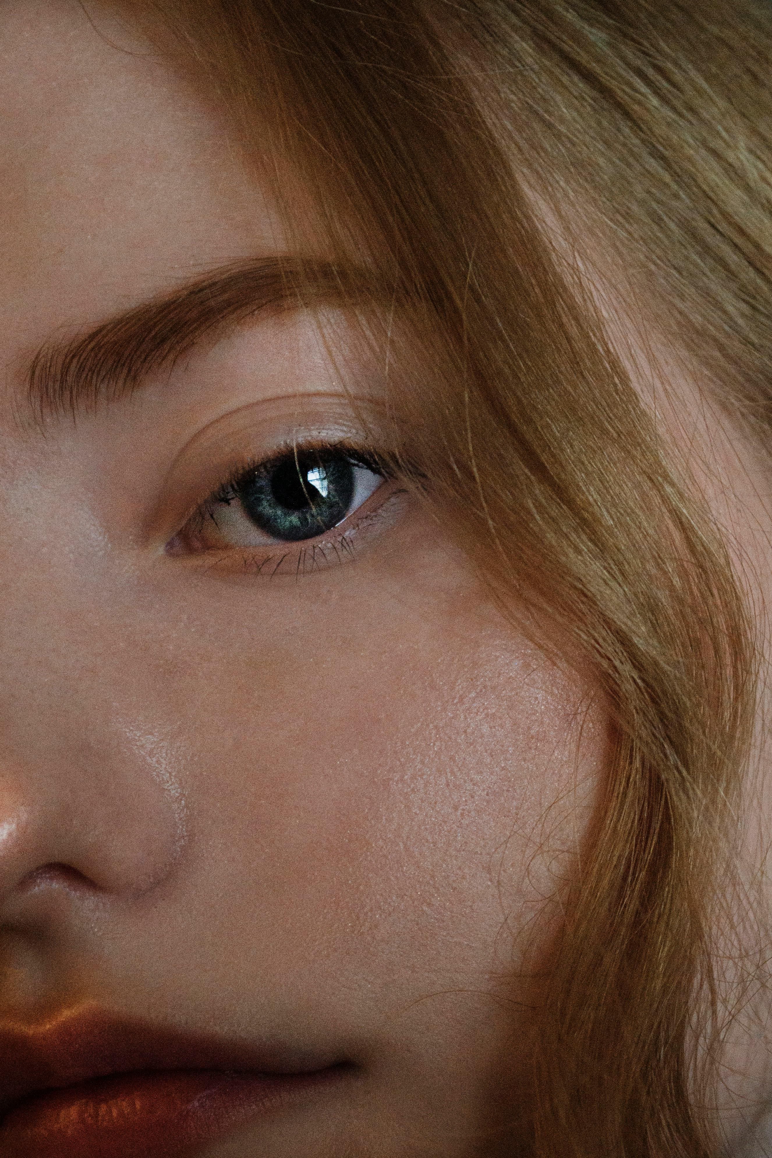 Close-up of eyelid collarettes surrounding eyelashes