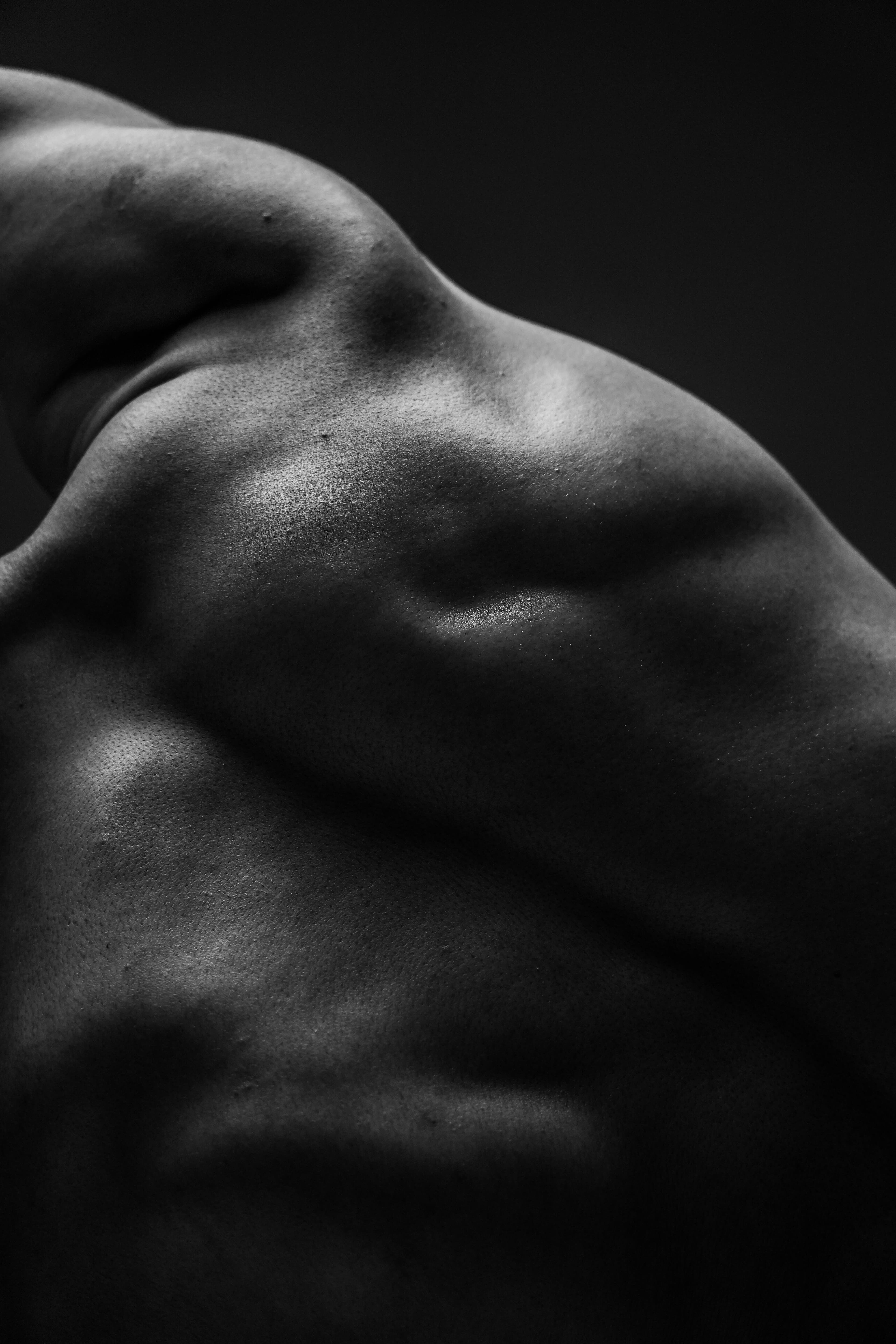 Close-up of a typical skin cyst showing its defined shape and slight redness