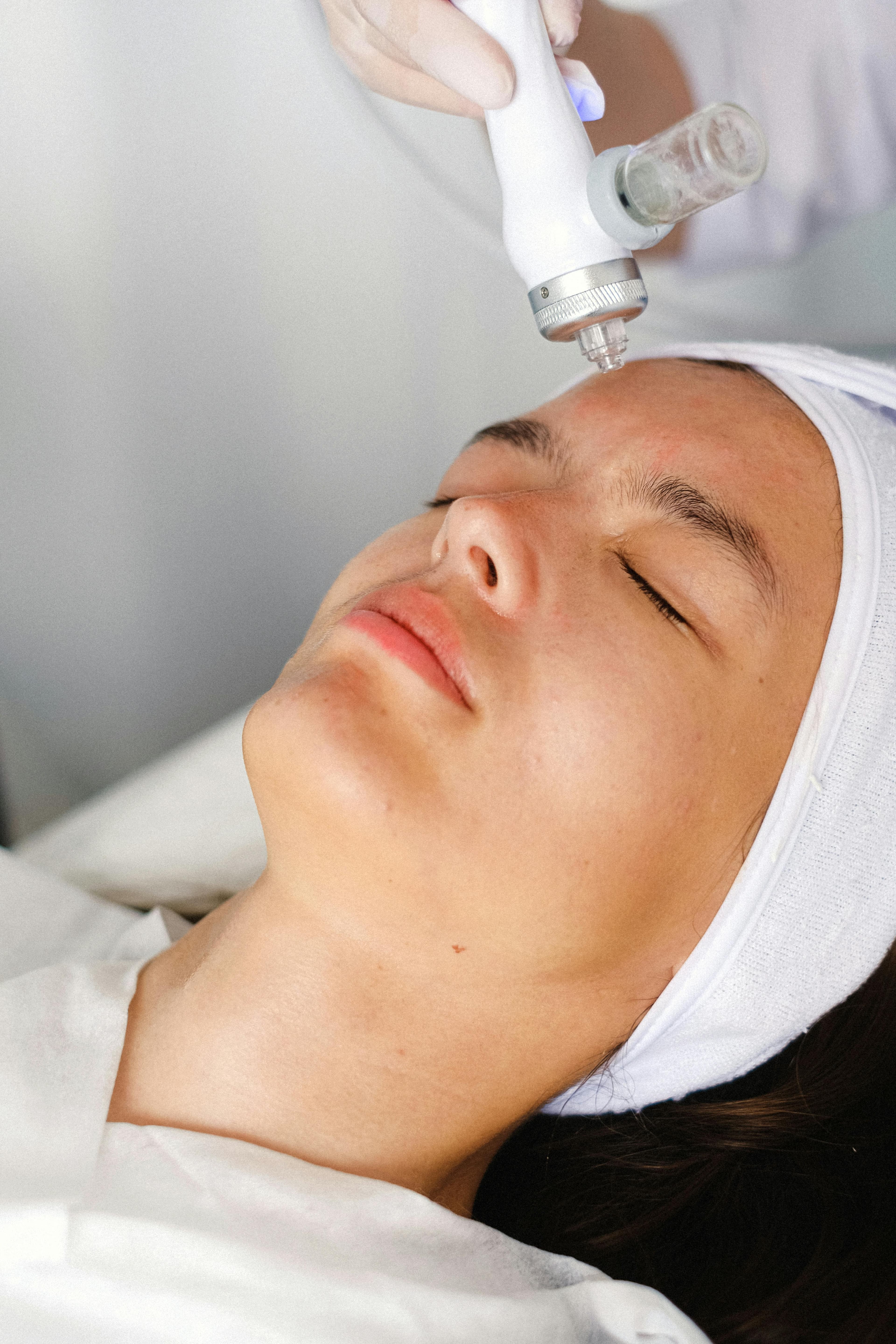 A medical professional performing laser therapy on a patient's lip to treat a vascular lesion