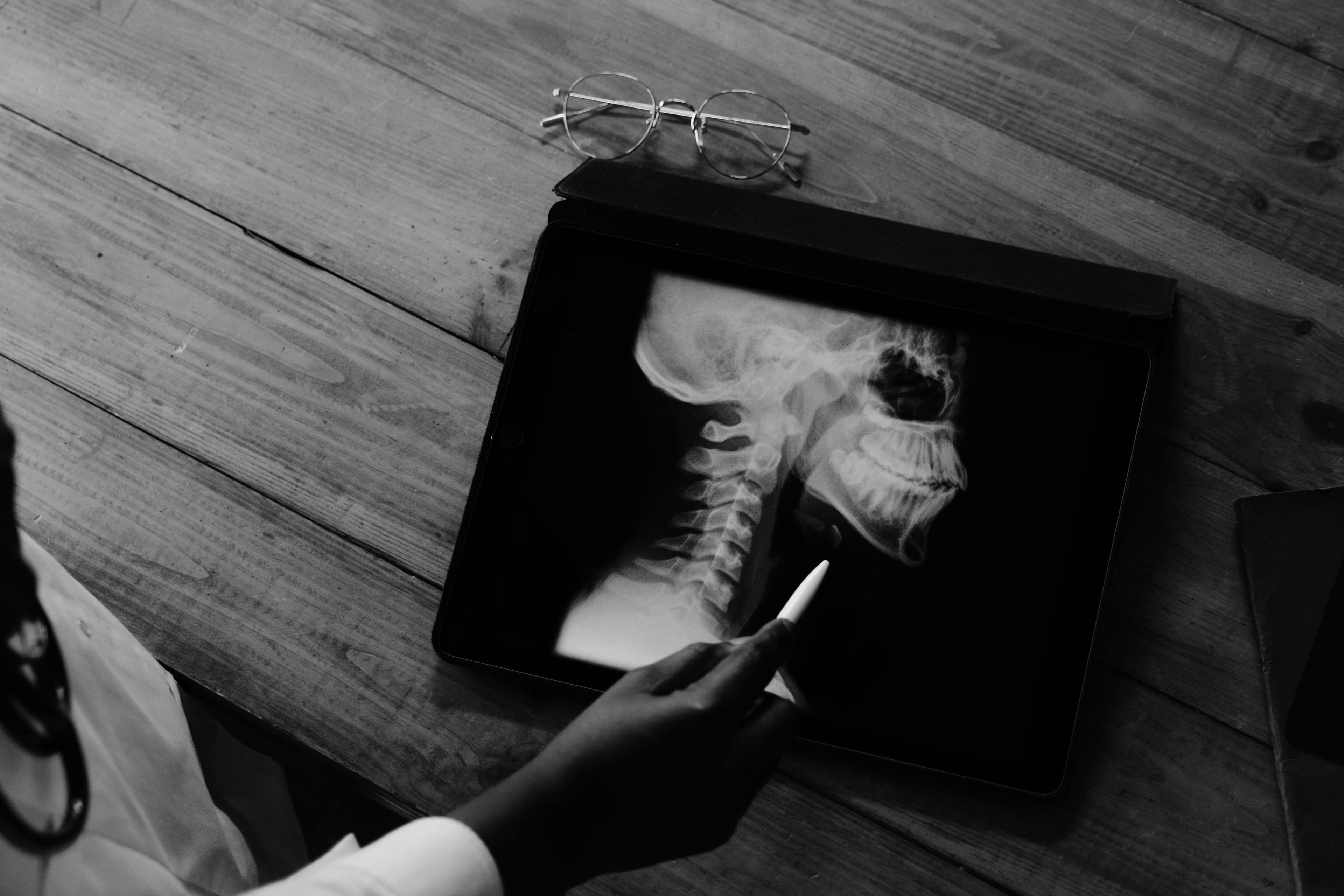 Ultrasound-guided regional anesthesia being performed on a patient with a hip fracture