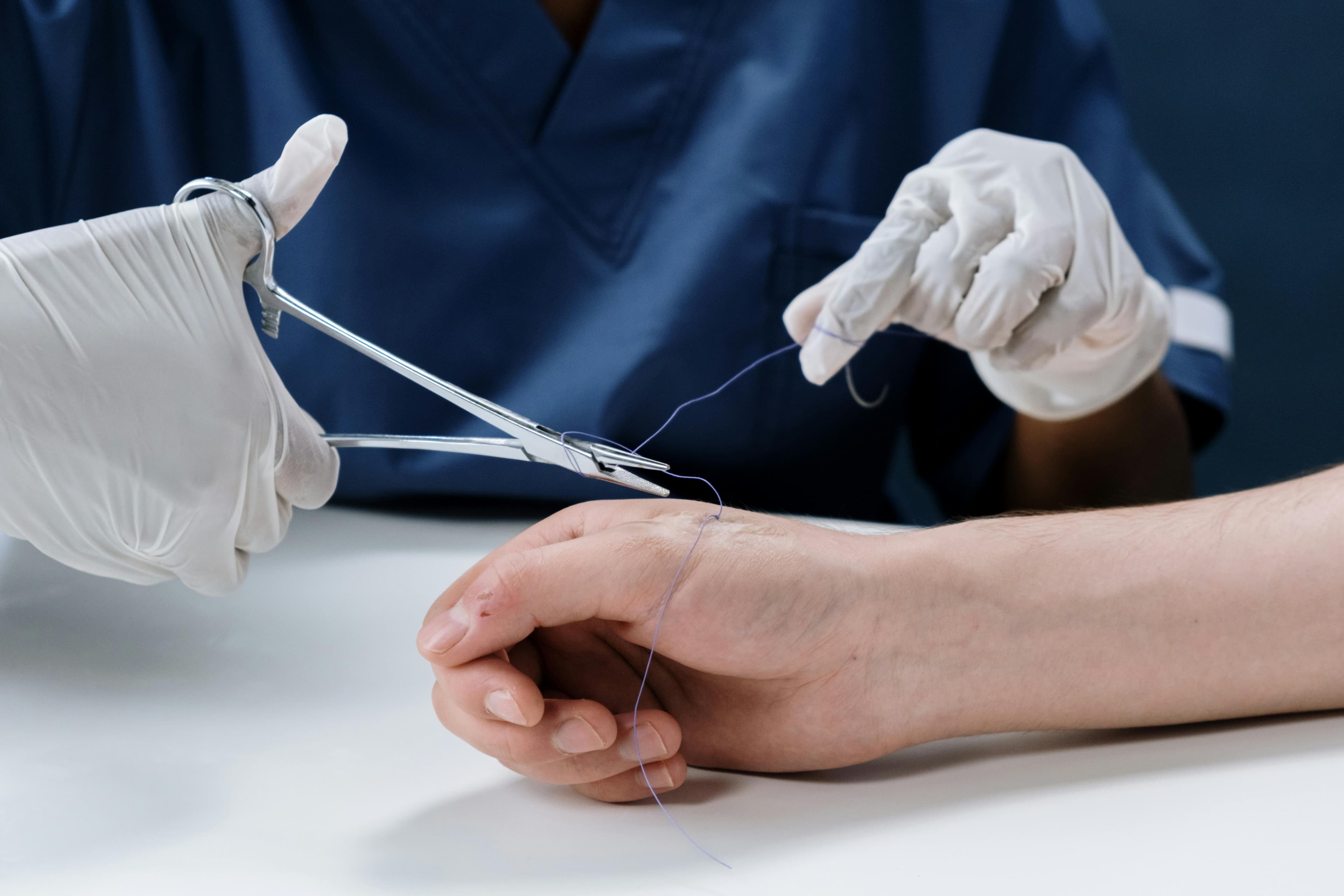 Close-up of corneal sutures during transplant surgery