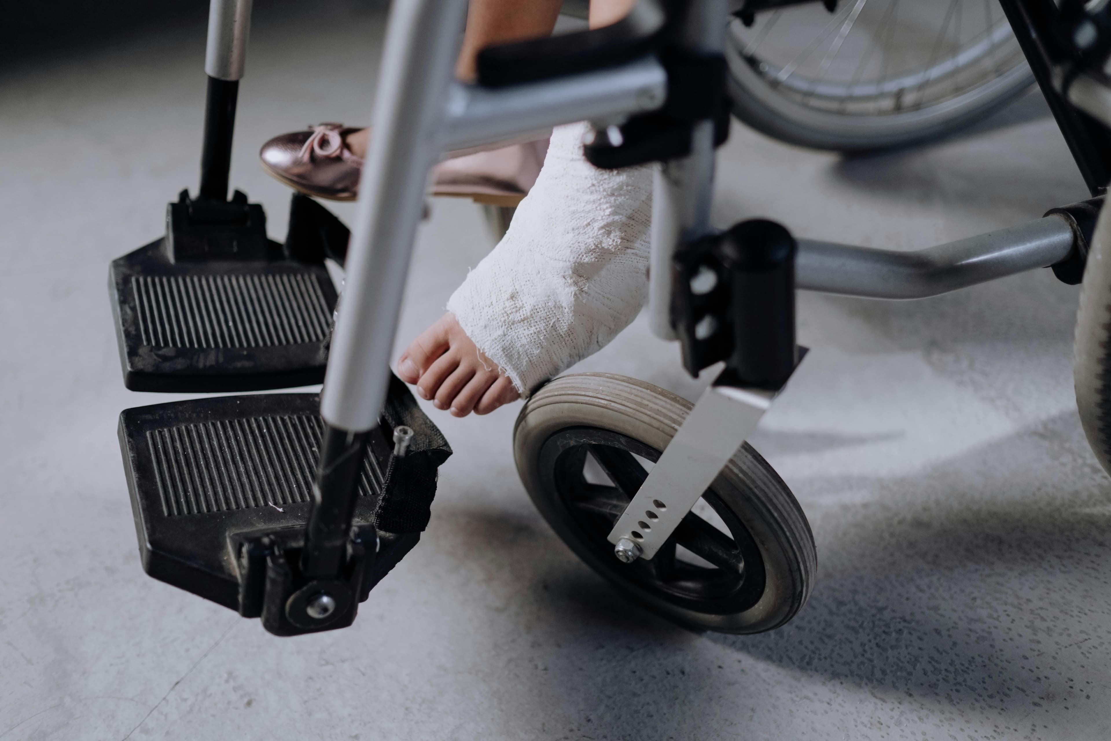 Patient undergoing physical therapy exercises for femur fracture recovery