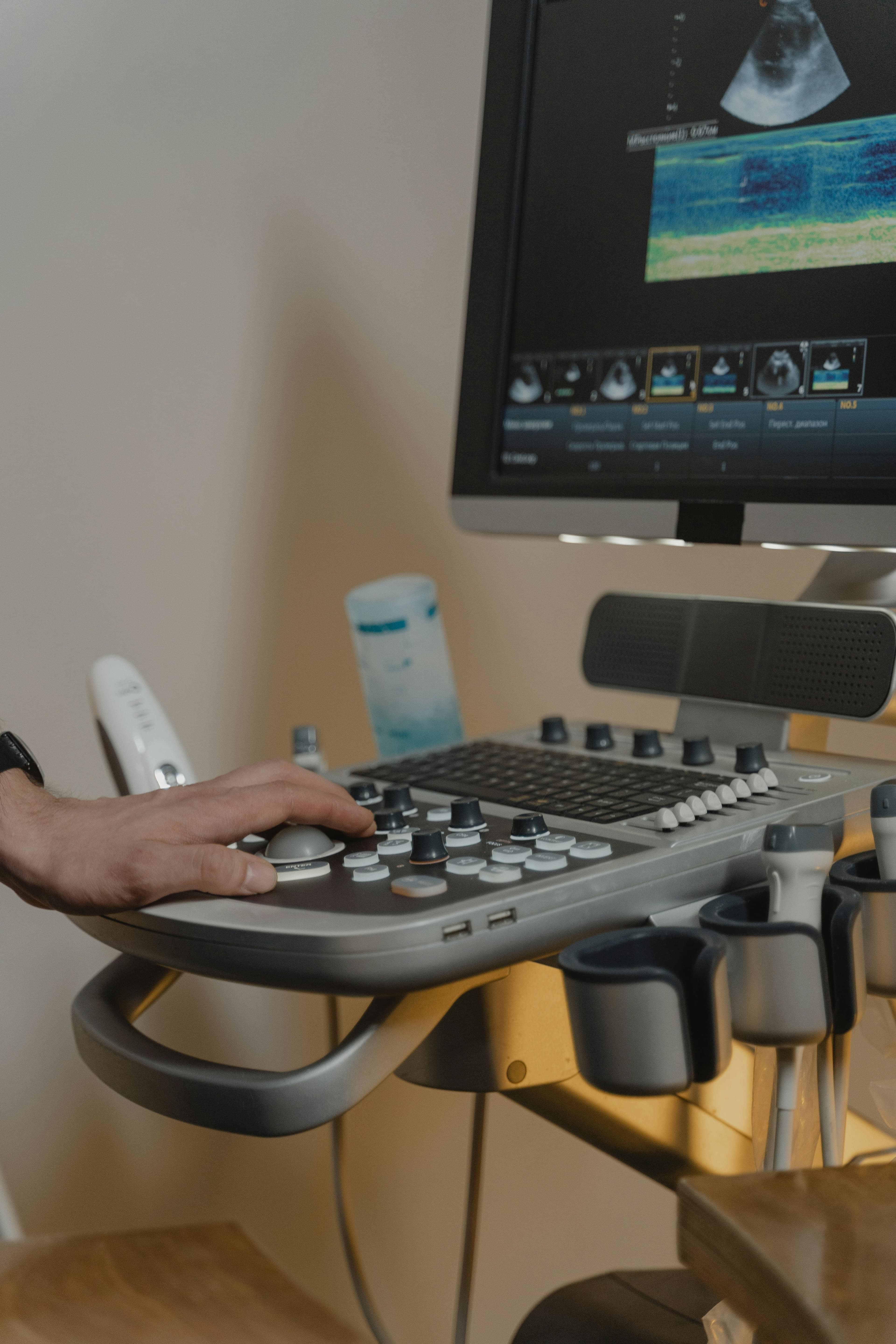 Echocardiogram machine and heart ultrasound image on screen
