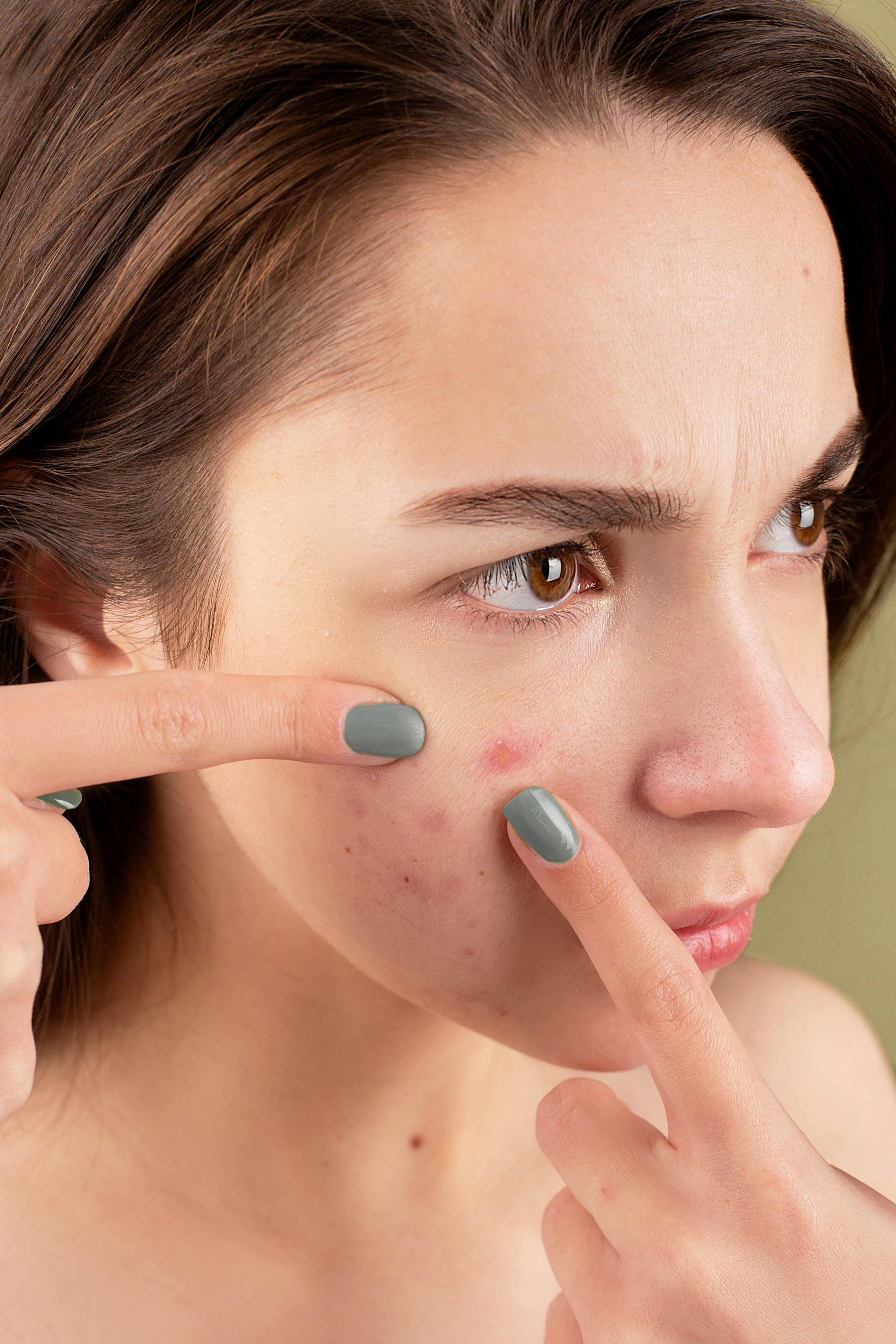 Person applying eyelid hygiene treatment