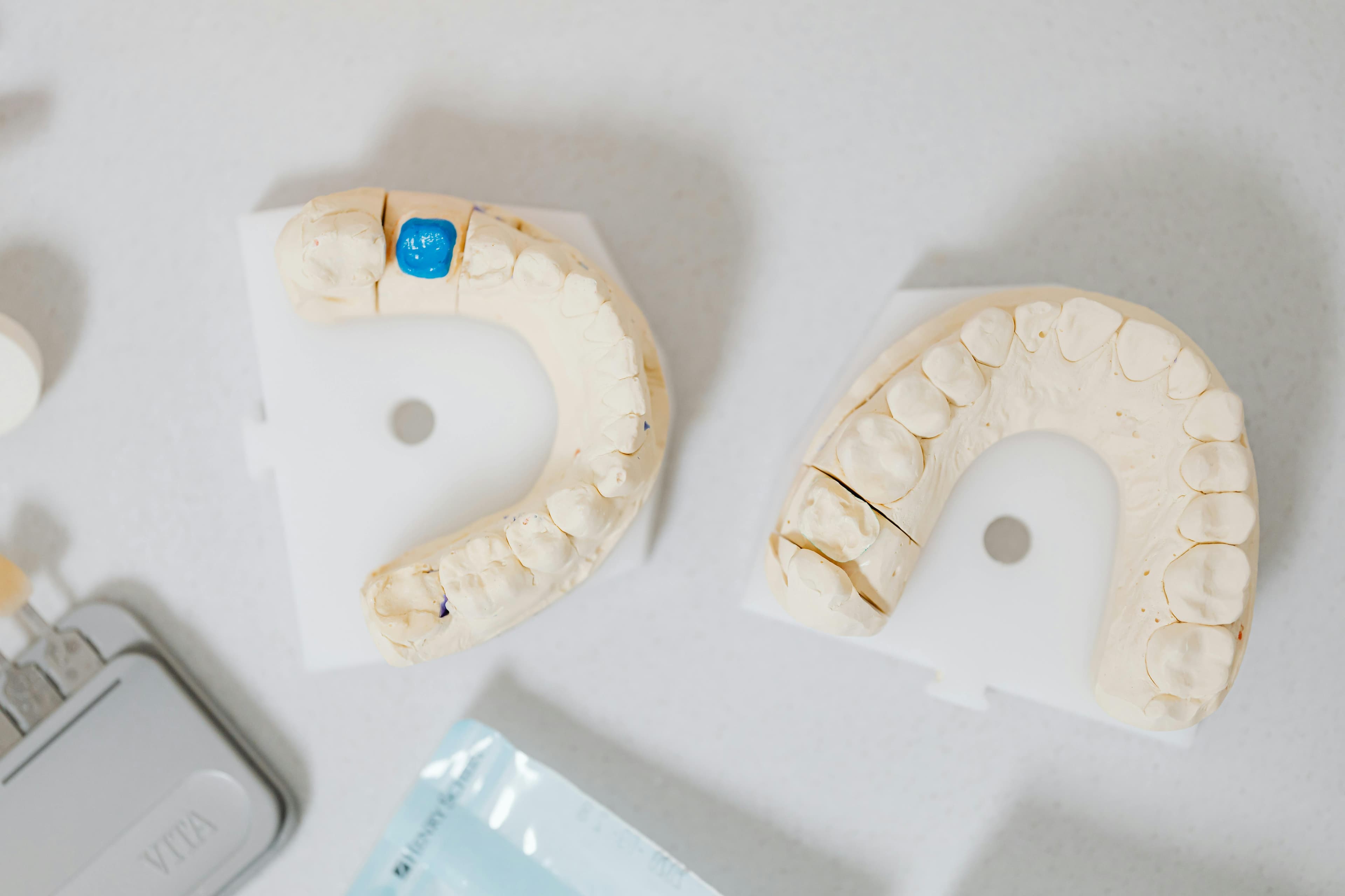 A microscopic view of a fractured ceramic dental implant showing its brittle nature
