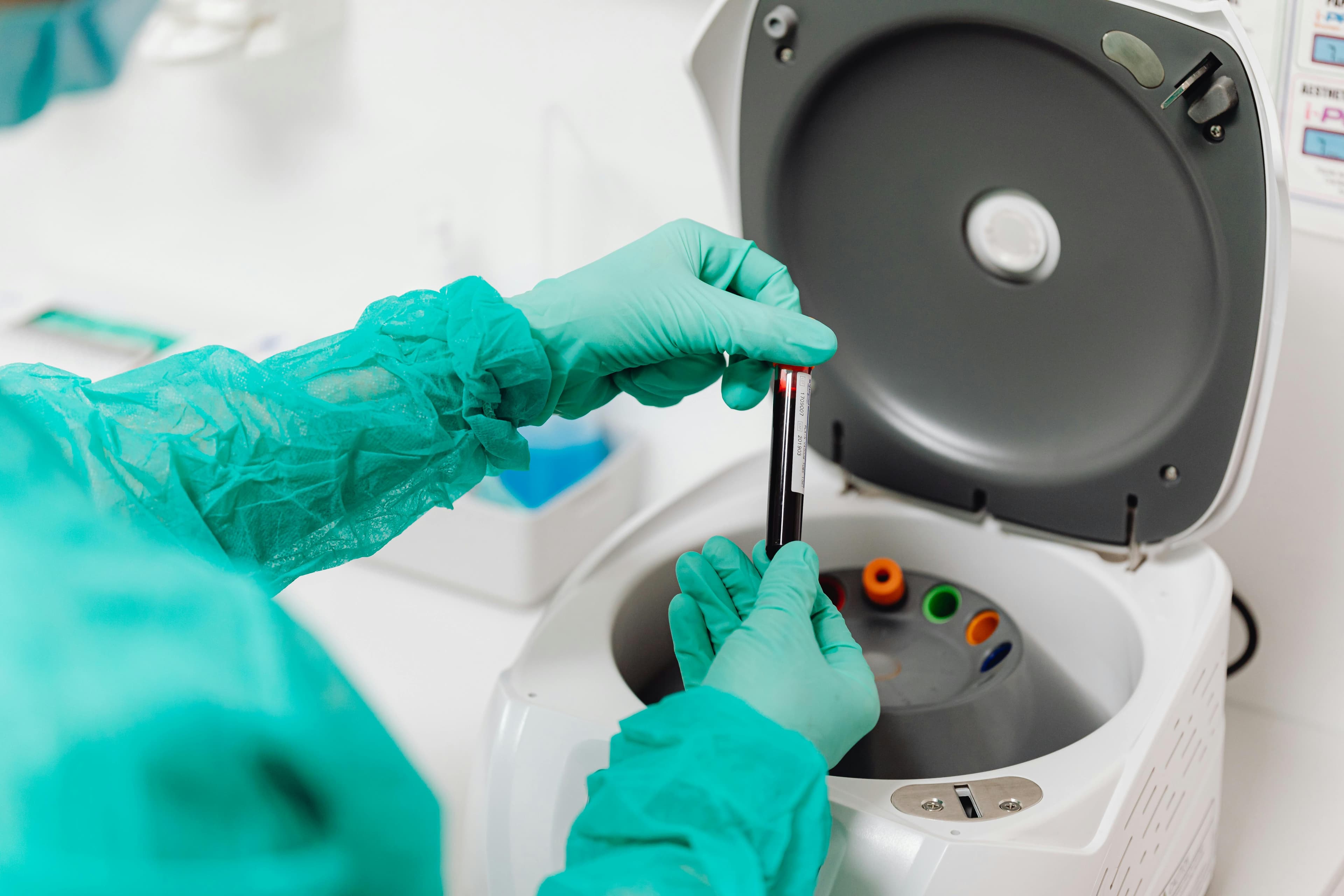 Laboratory technician preparing platelet-rich plasma sample