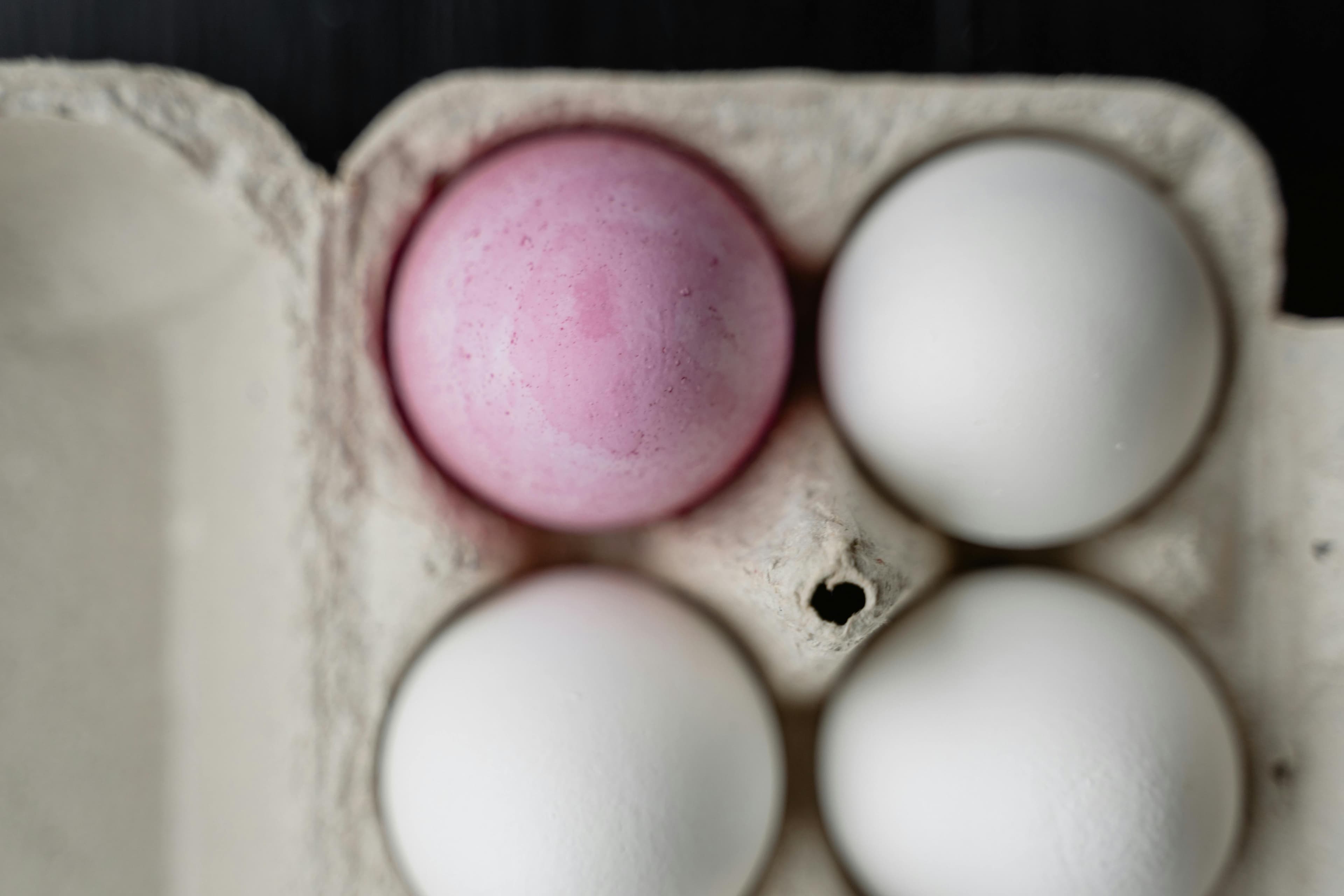 MRI scan images showing the difference between with and without contrast dye