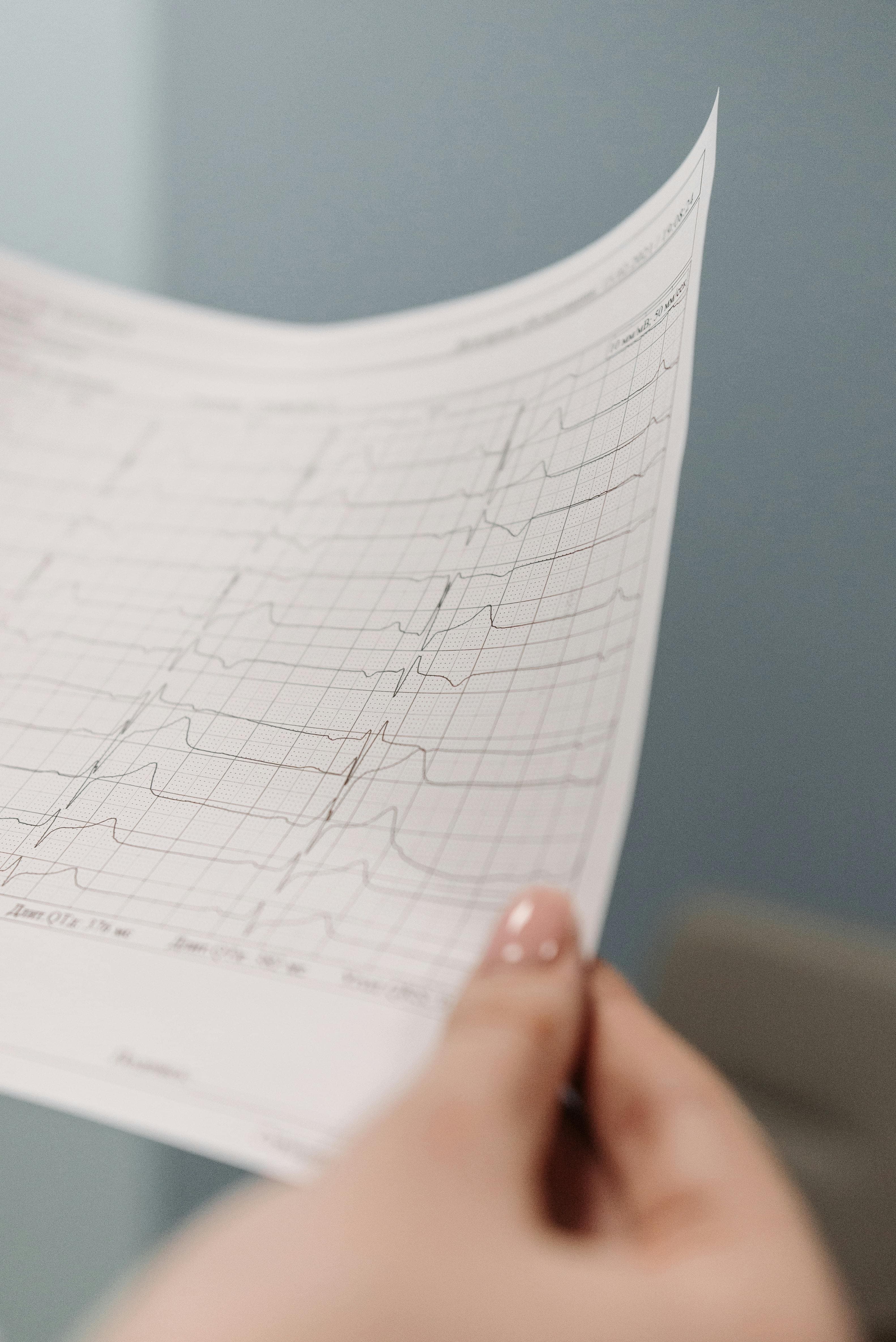 A chart comparing the accuracy of in-ear ECG measurements to standard Lead I ECG for various cardiac parameters
