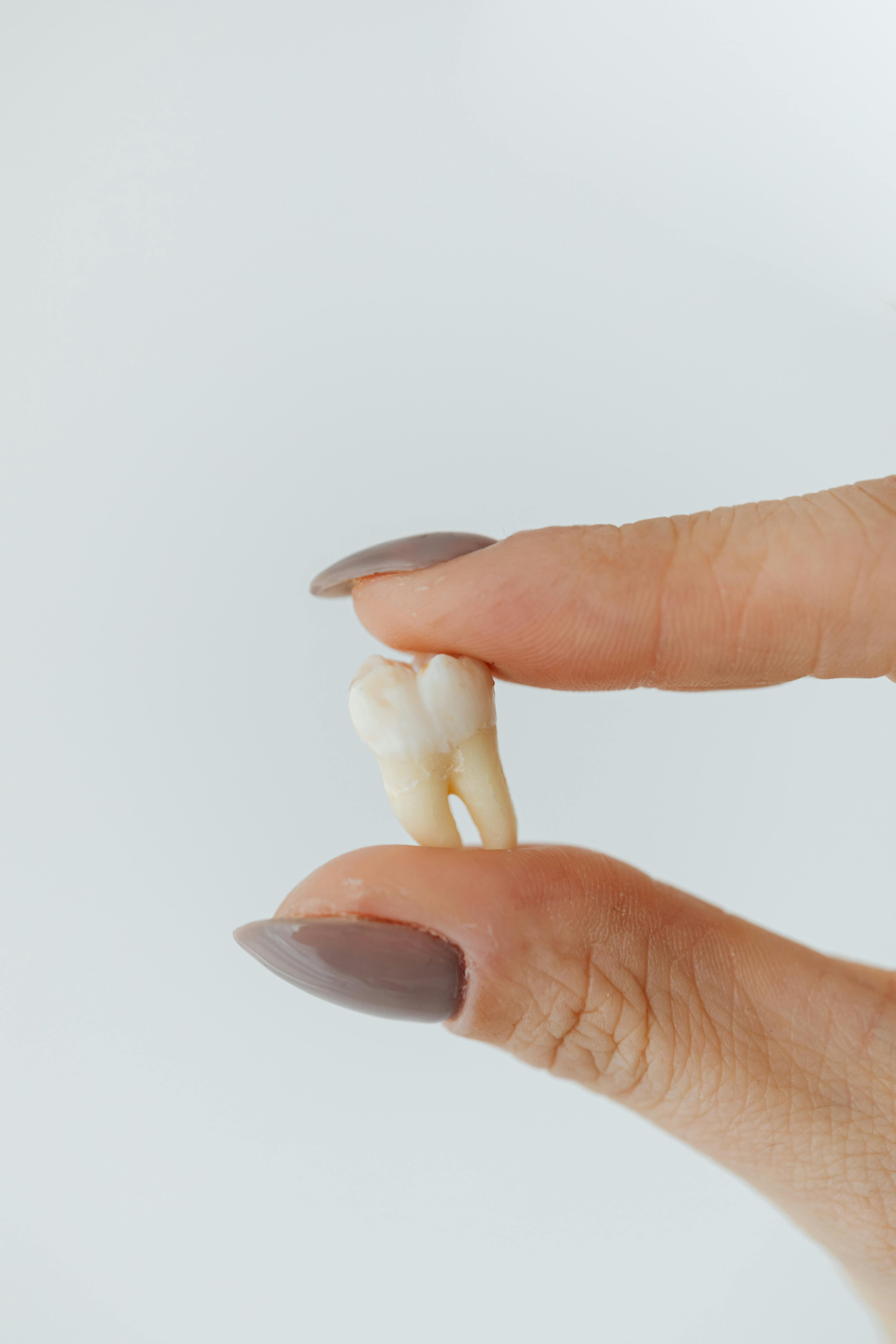 Dentist performing a simple molar extraction