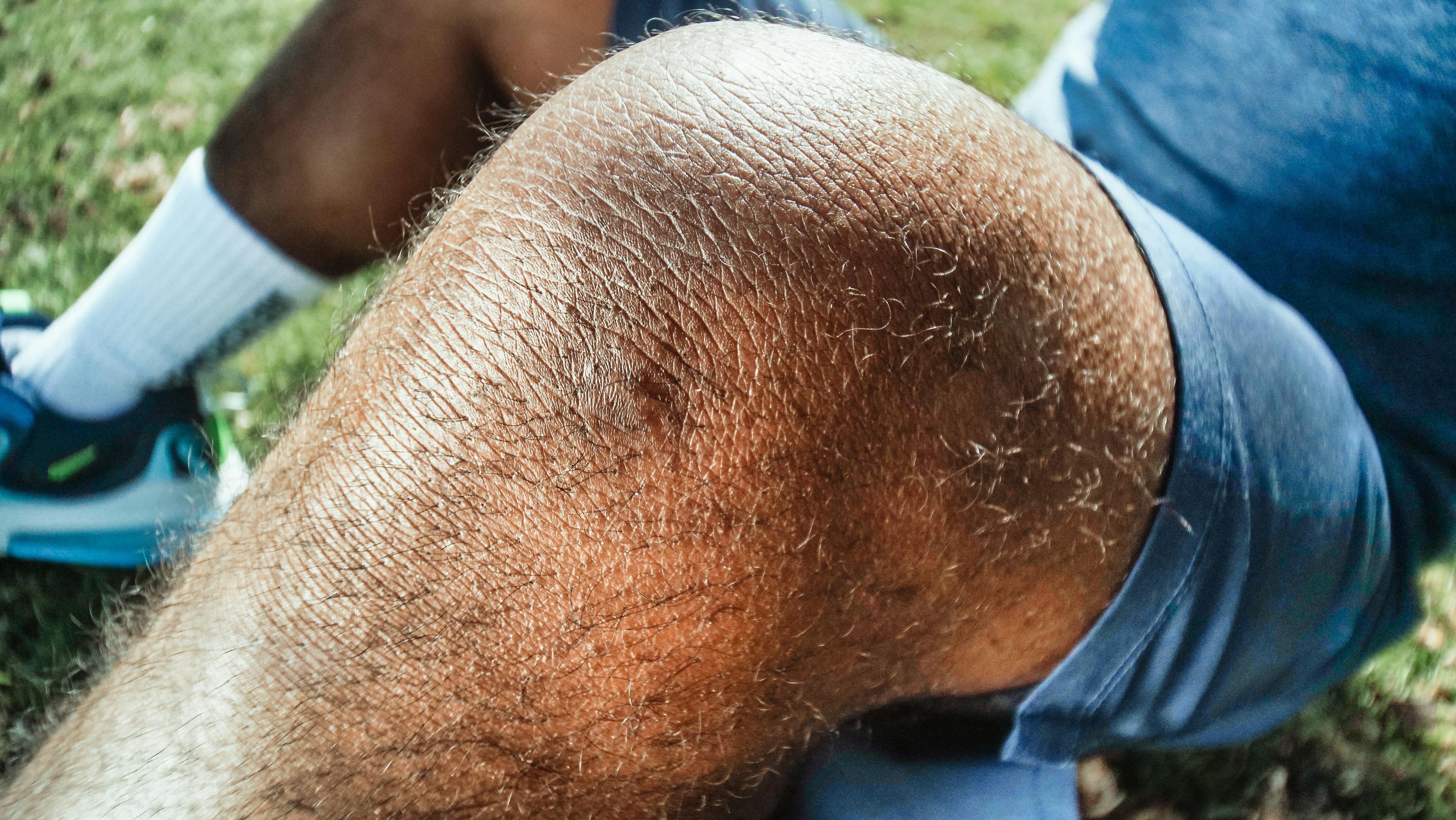 Close-up of healing skin showing new pink tissue formation under a partially detached scab