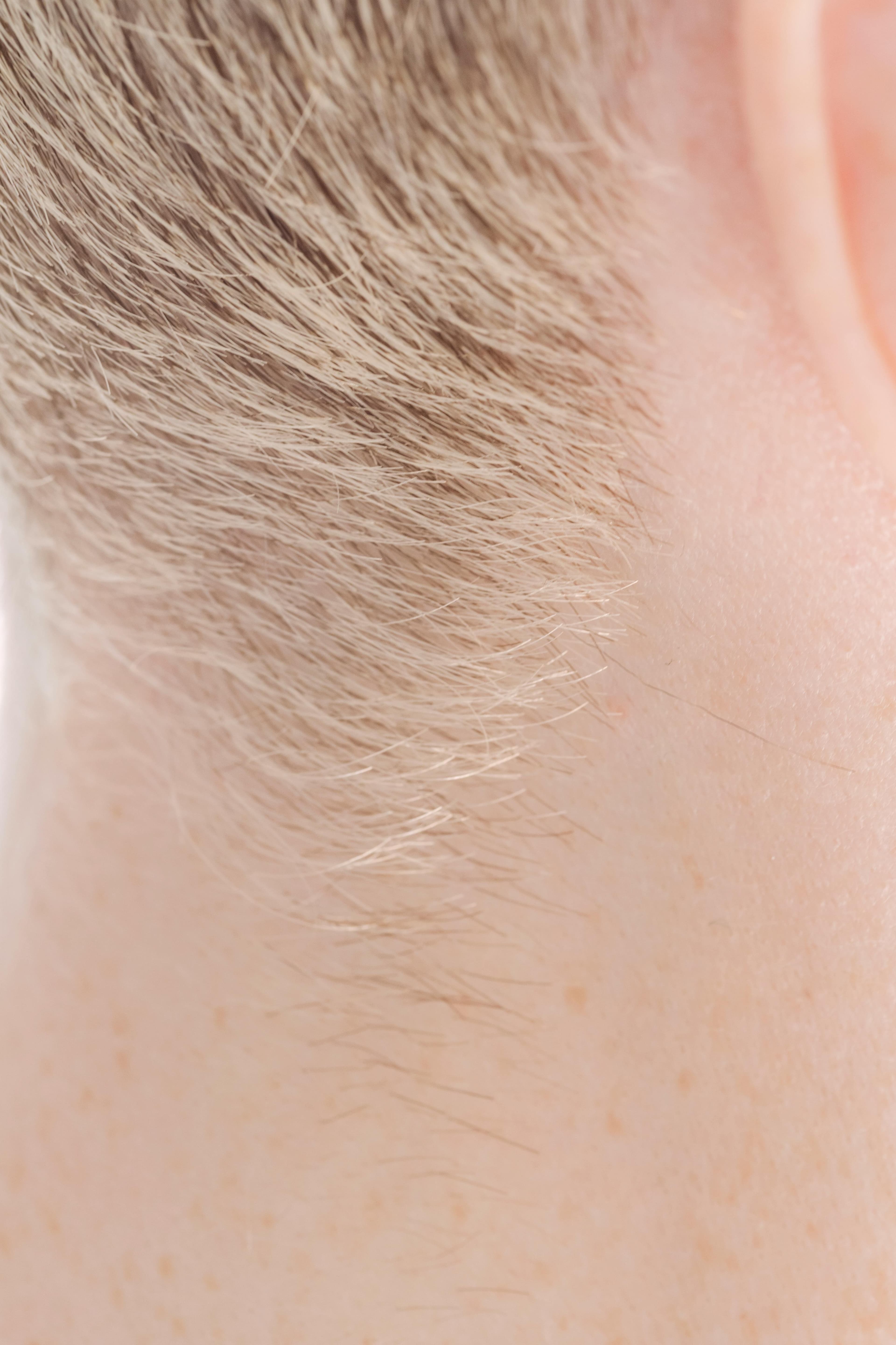 Microscopic view of hair follicles and scalp skin