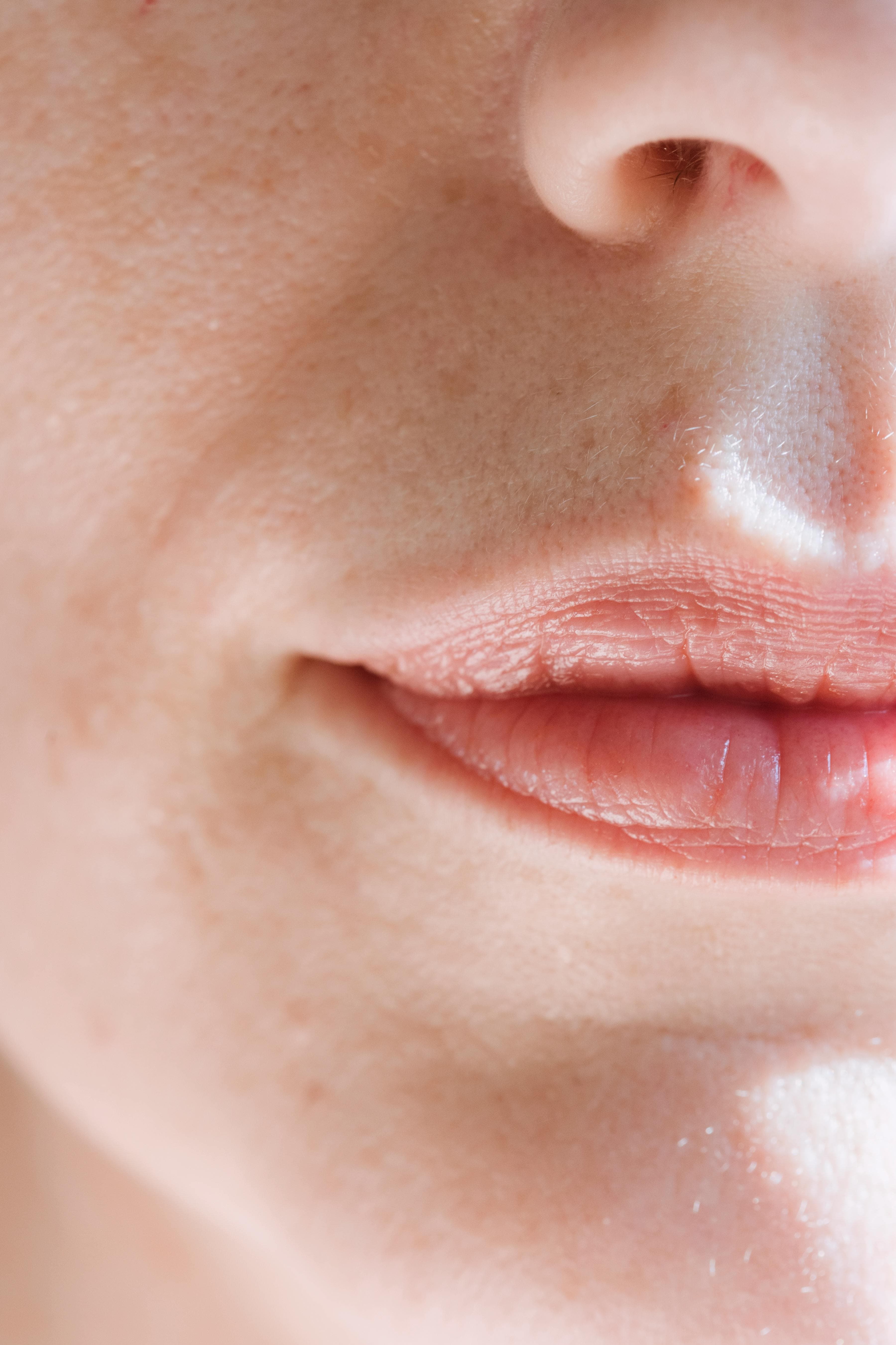 Diagram of facial muscles and nerves around the nose