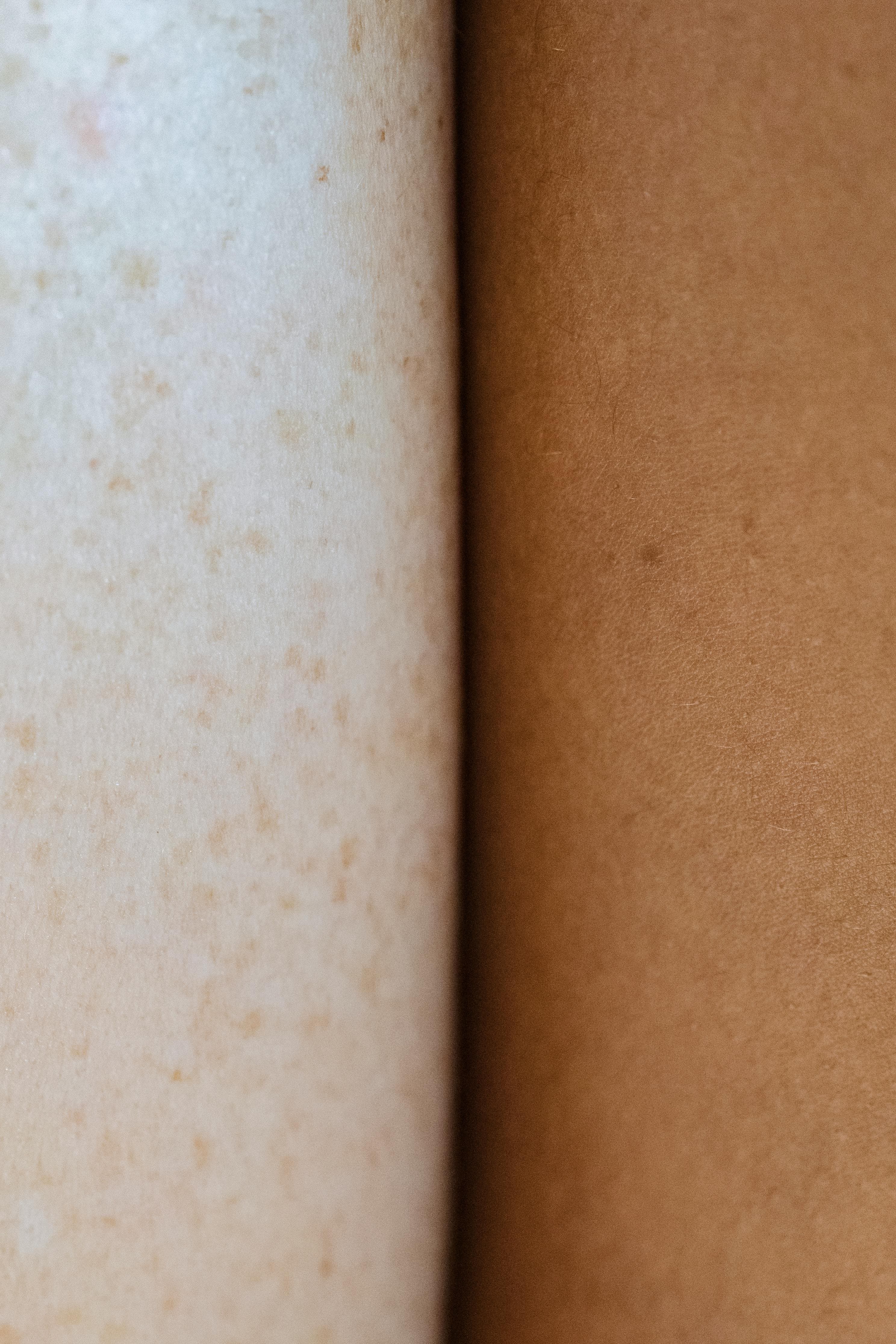 Side-by-side comparison of different breast implant sizes on various body types
