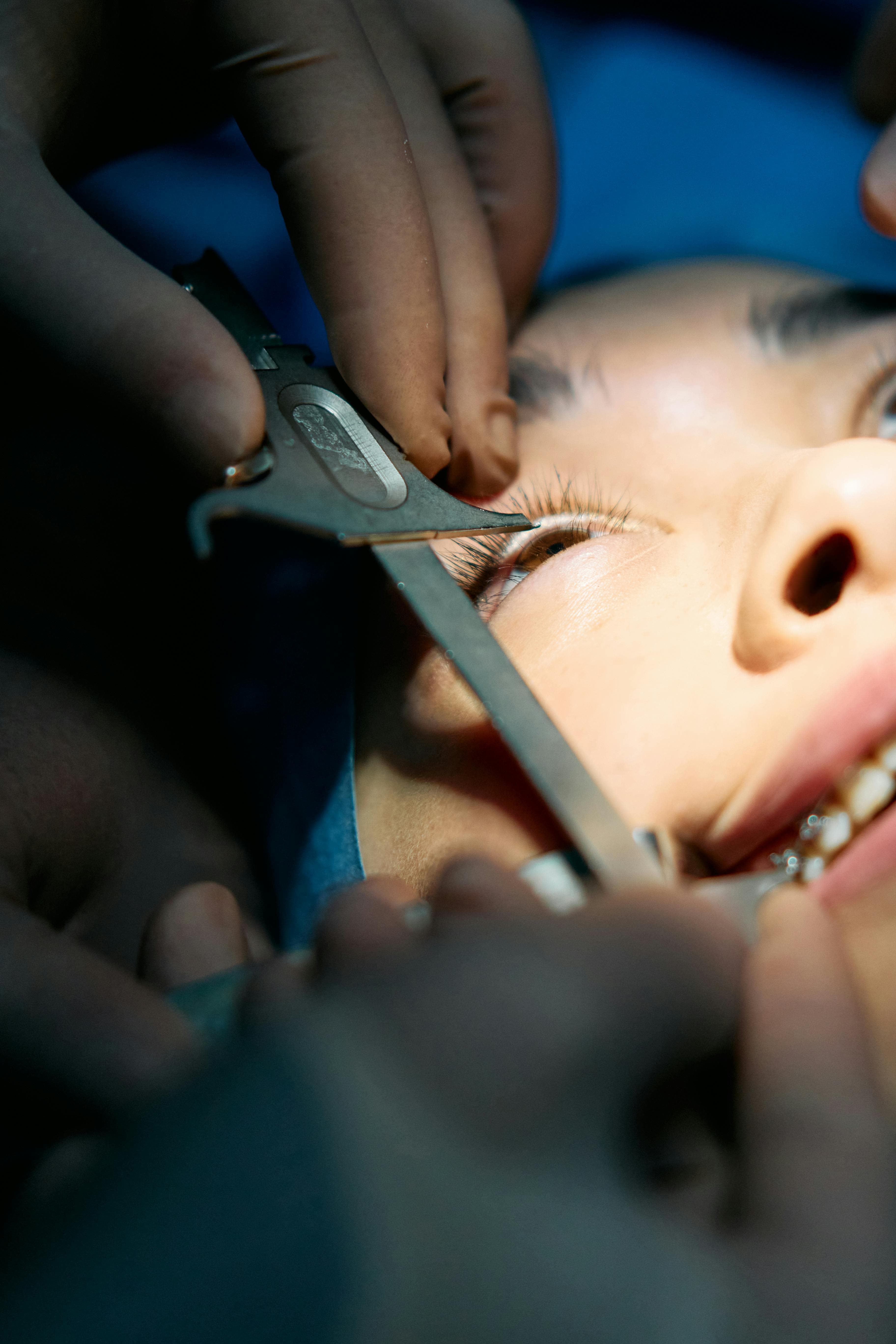 Close-up of a watery eye after cataract surgery