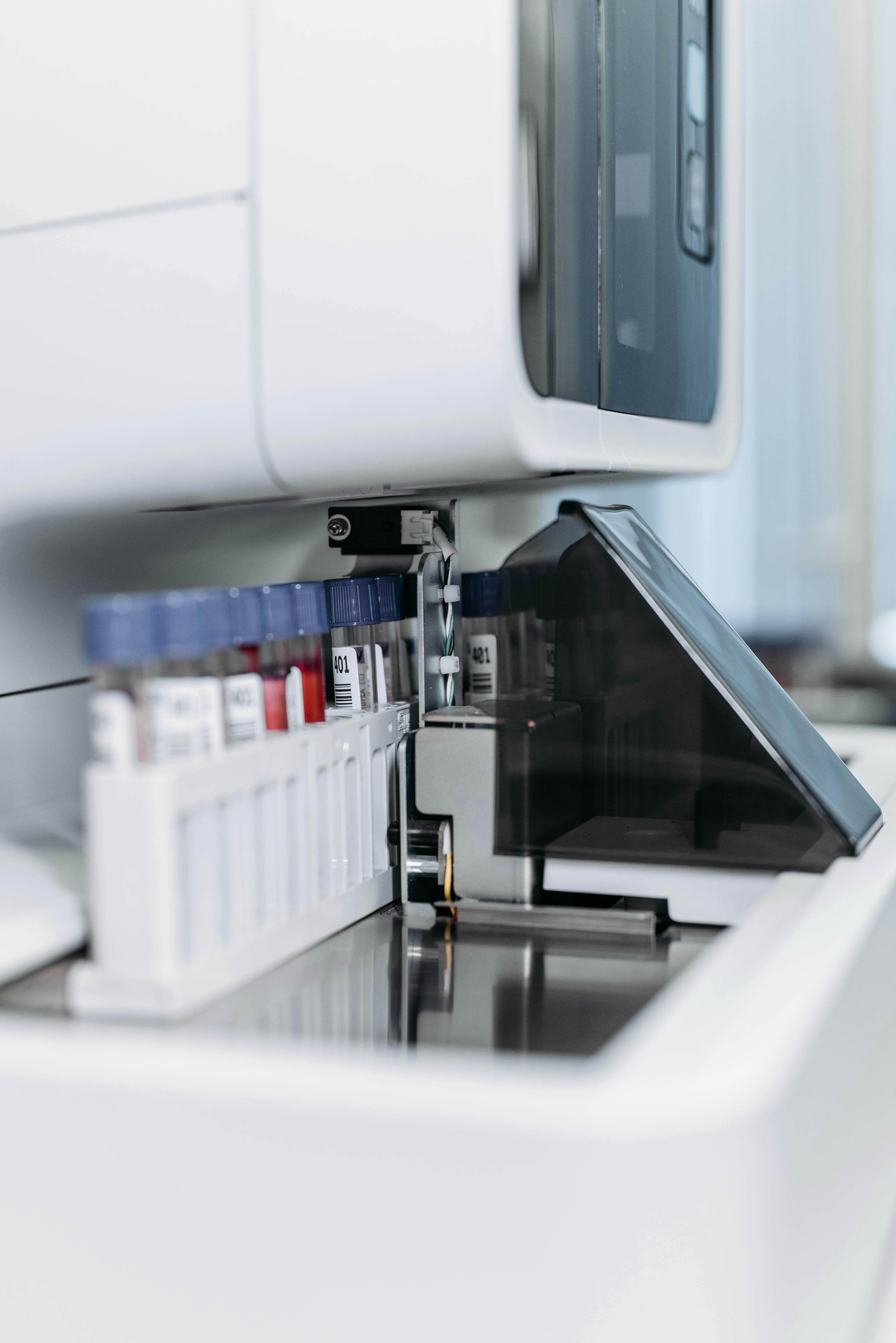 Advanced laboratory equipment used for kidney disease diagnostics