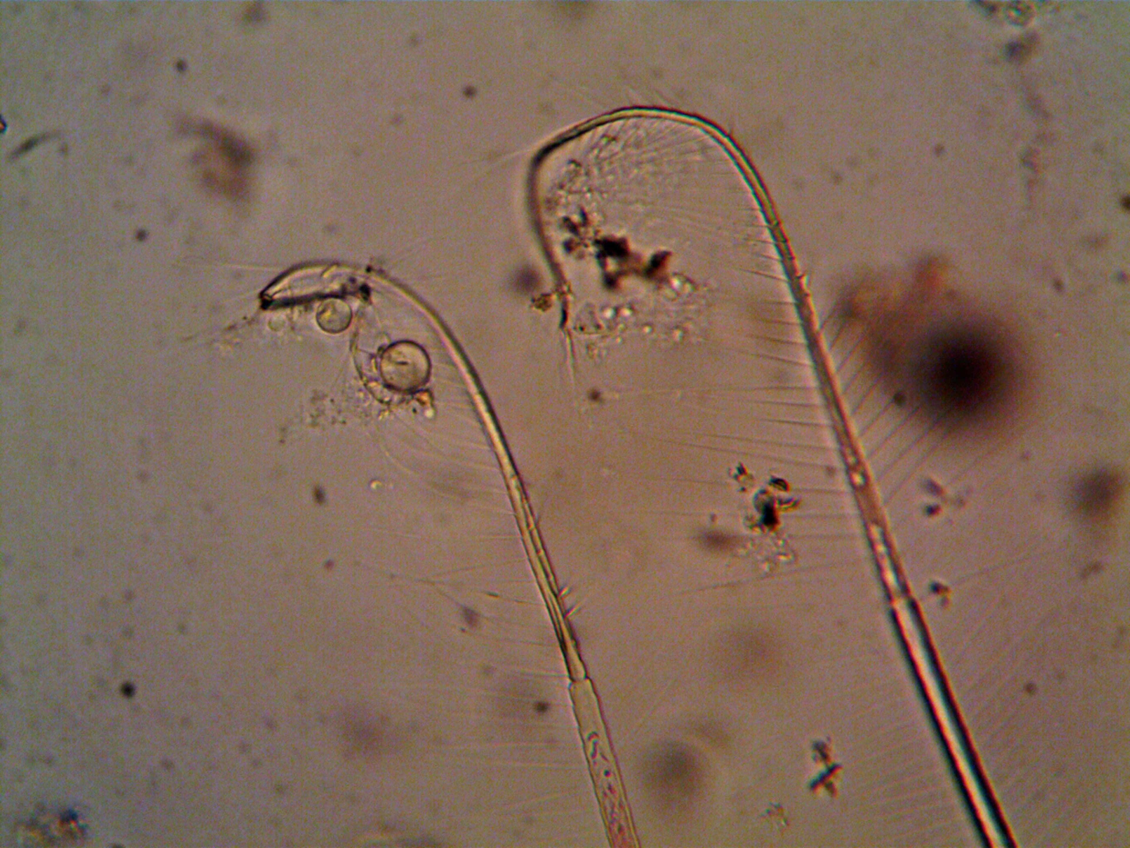 Microscopic image of H. pylori bacteria in the stomach lining