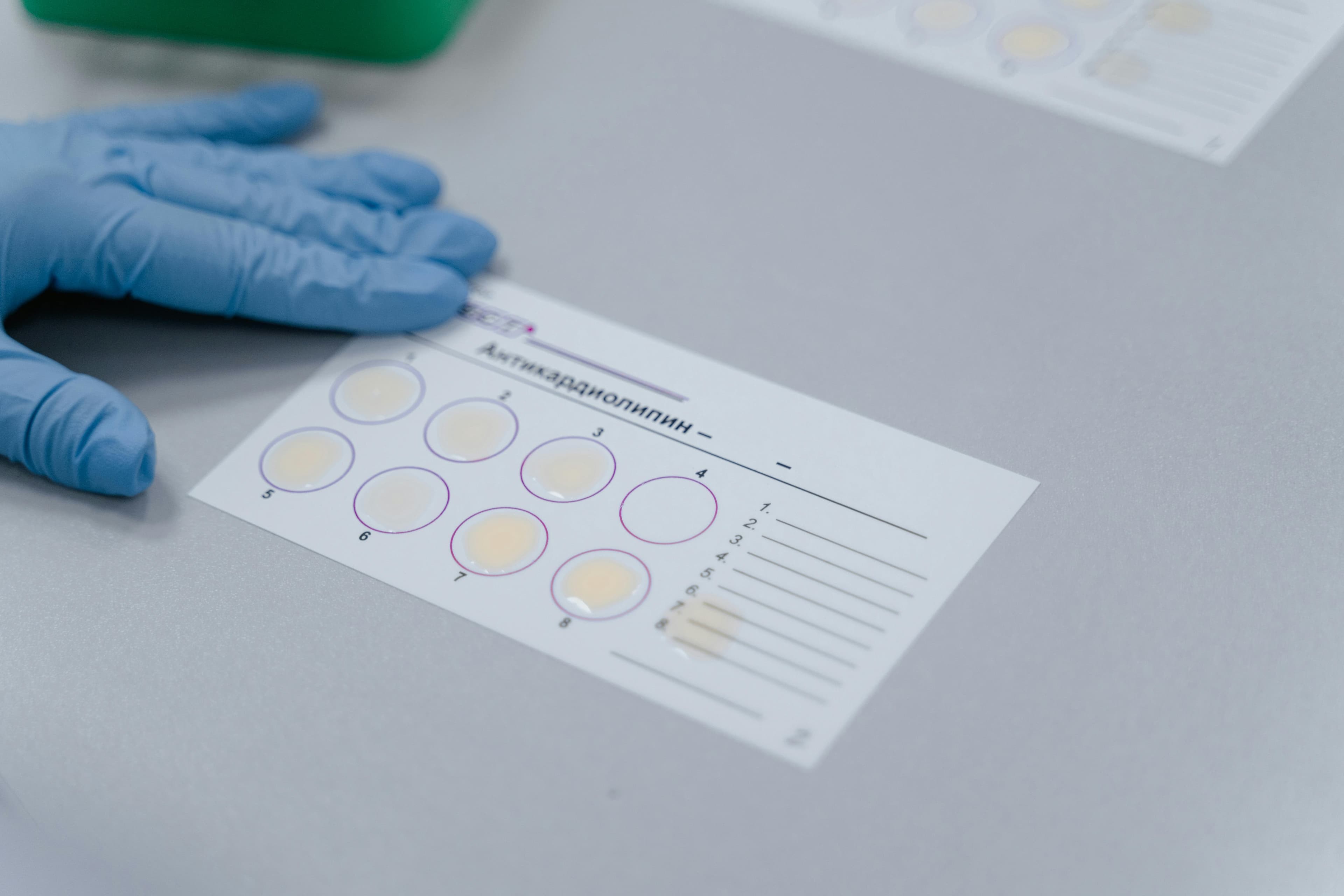 A scientist analyzing immunological test results in a laboratory setting