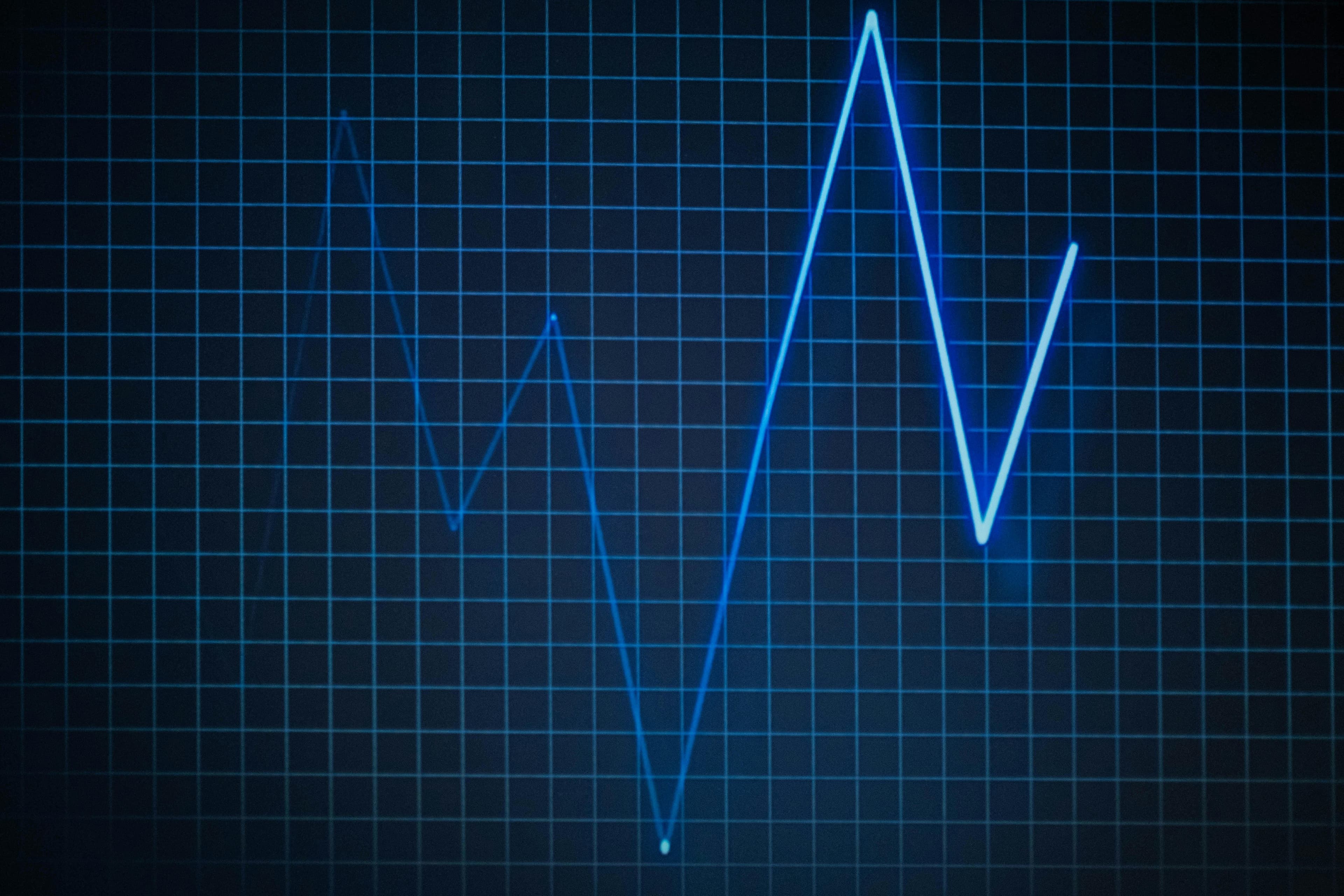 An electrocardiogram showing typical patterns associated with high blood pressure